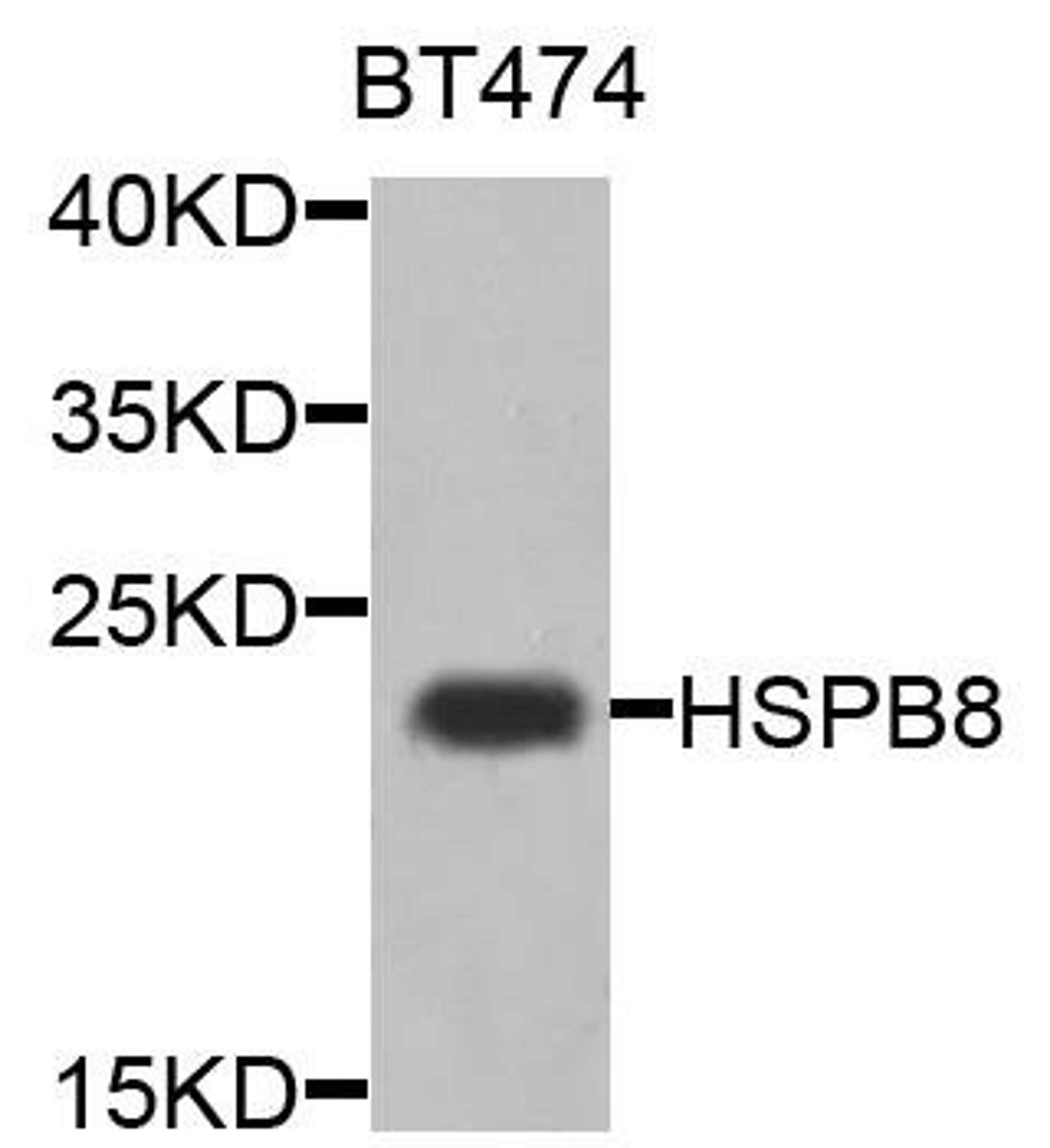 Western blot analysis of extracts of BT474 cells using HSPB8 antibody