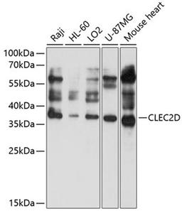 Western blot - CLEC2D antibody (A10421)