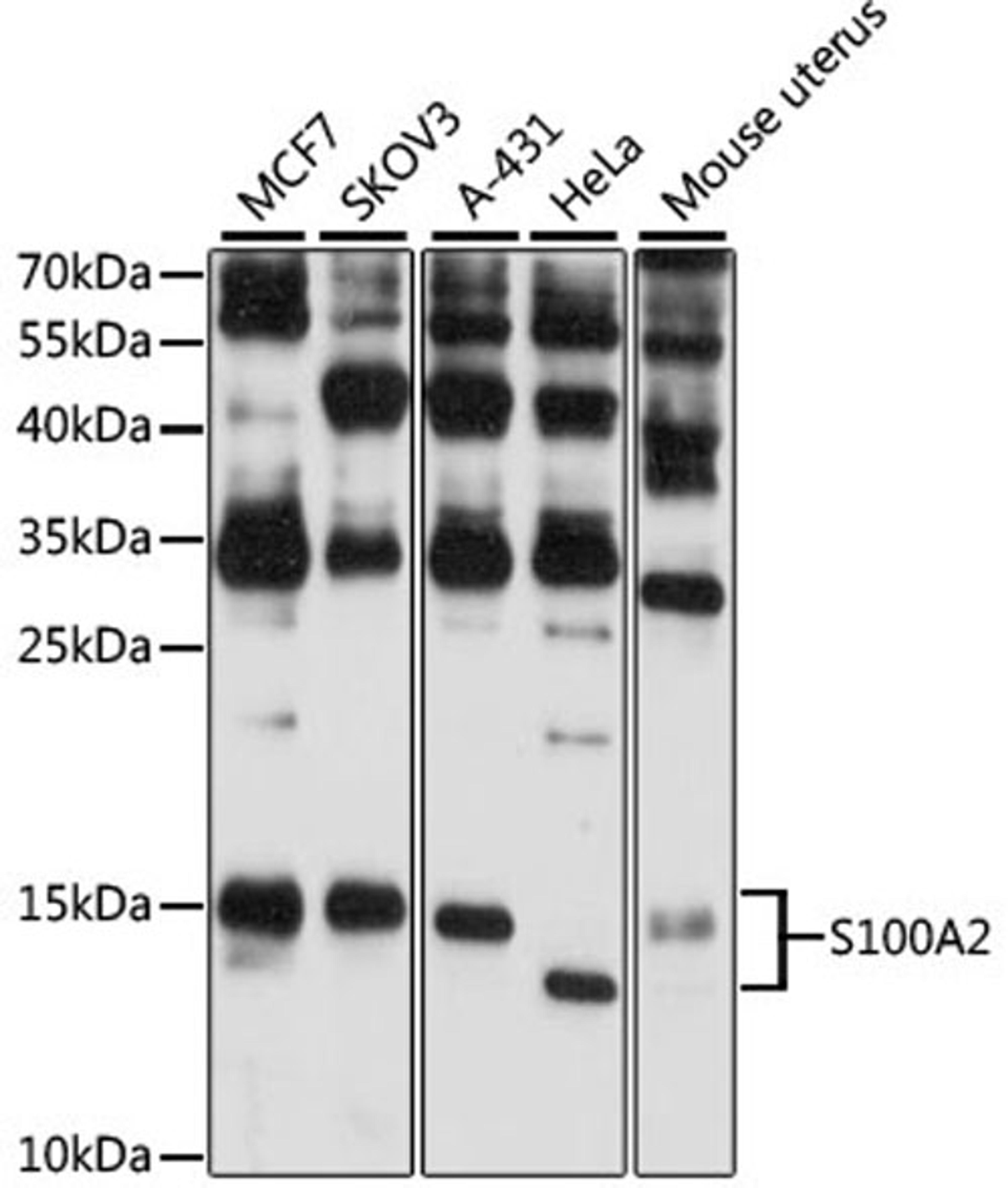 Western blot - S100A2 antibody (A12647)