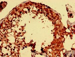 Immunohistochemistry analysis of human testis tissue using CSB-PA03729A0Rb at dilution of 1:100