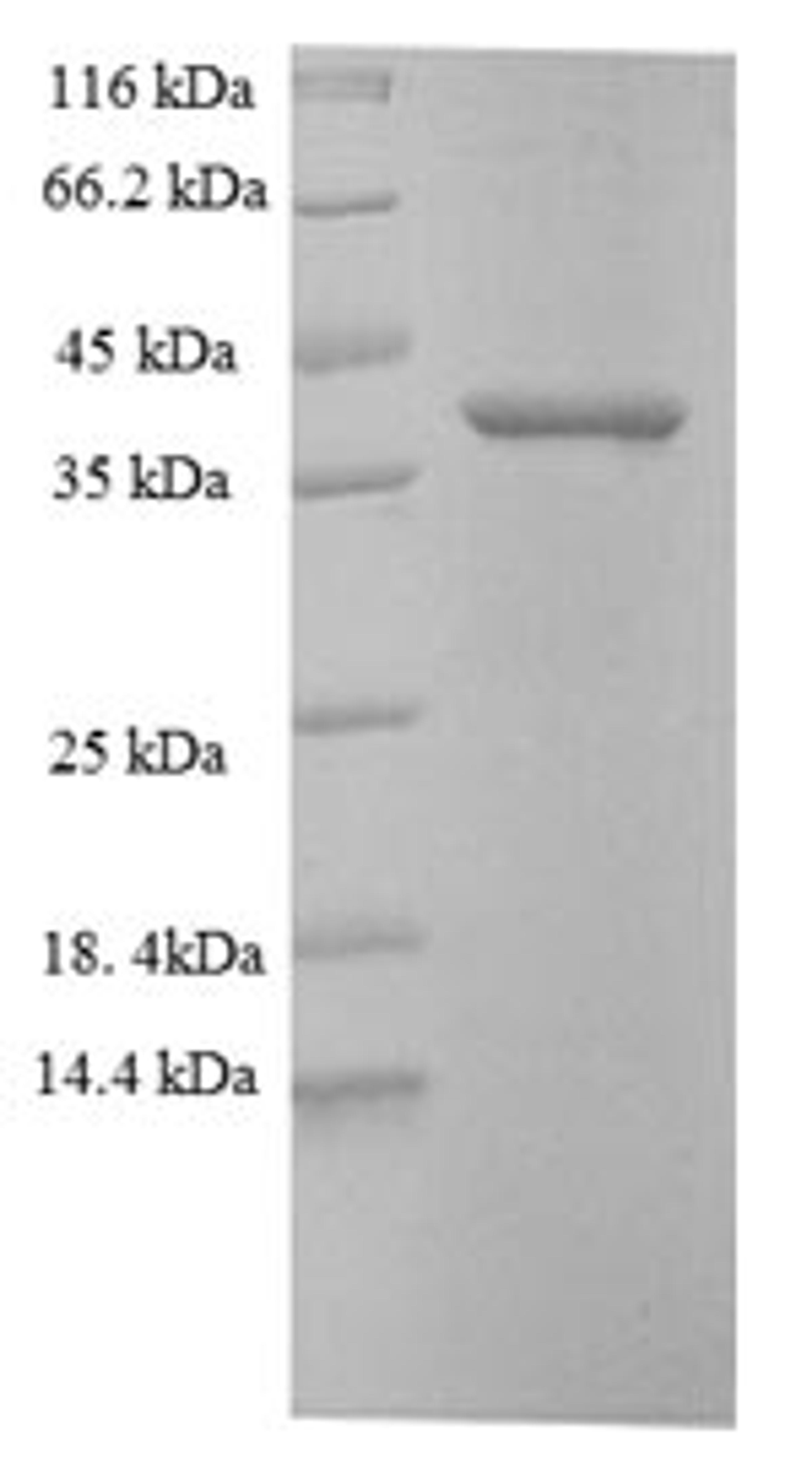 (Tris-Glycine gel) Discontinuous SDS-PAGE (reduced) with 5% enrichment gel and 15% separation gel.