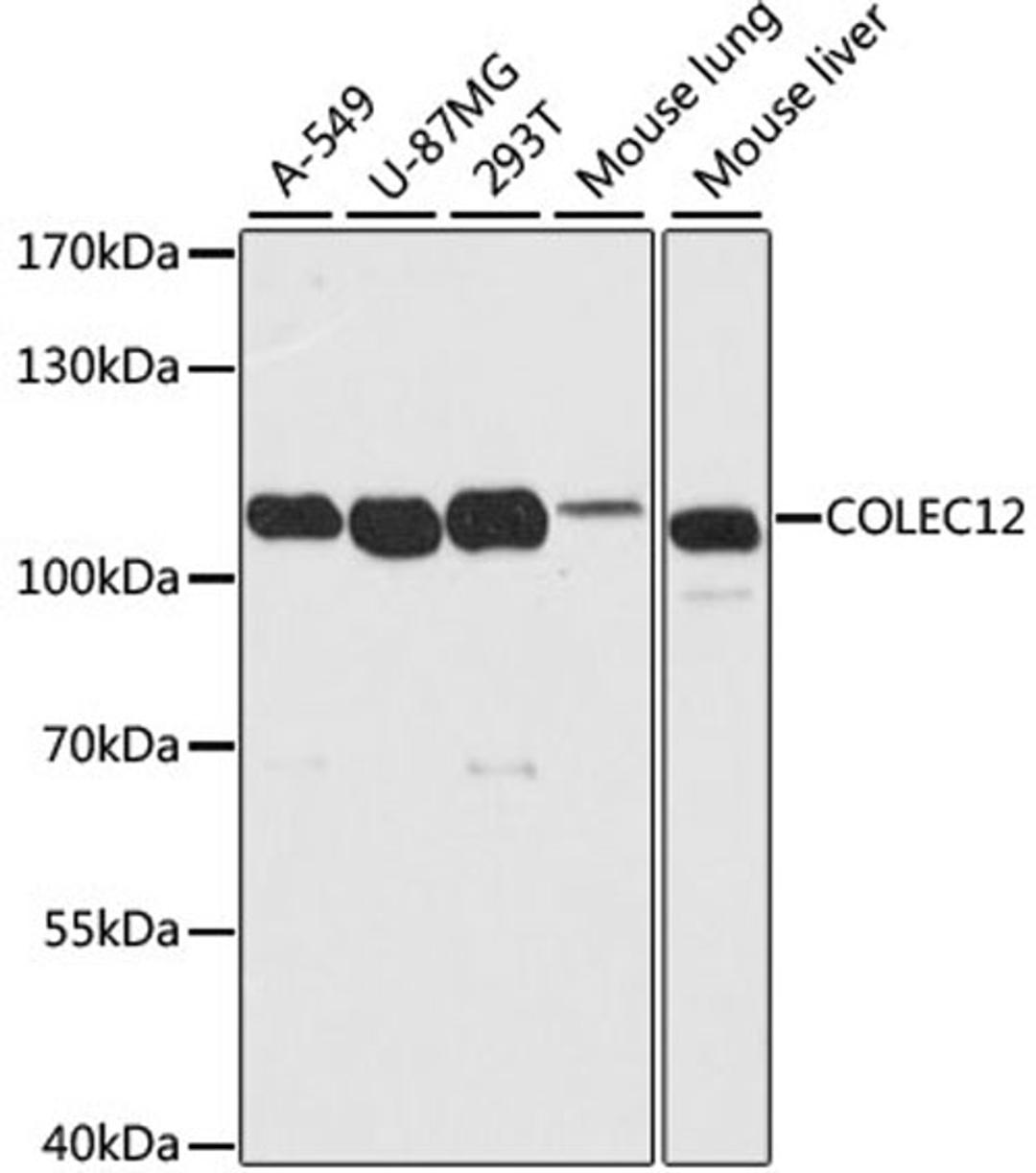 Western blot - COLEC12 antibody (A10422)