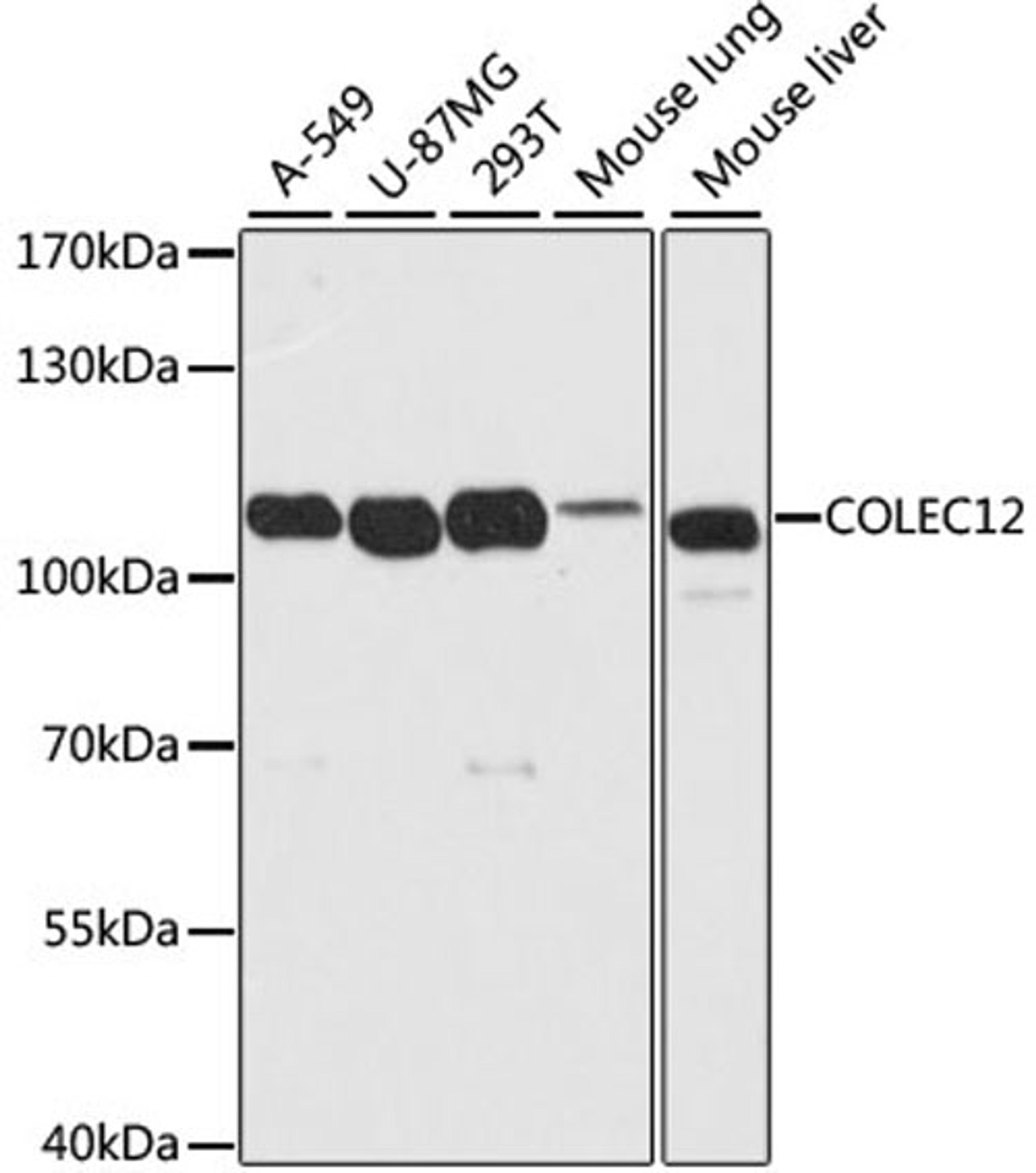 Western blot - COLEC12 antibody (A10422)