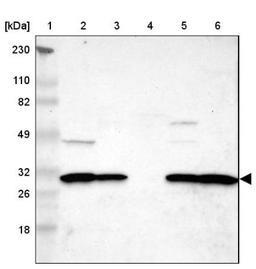 Western Blot: ZCCHC16 Antibody [NBP1-81888] - Lane 1: Marker [kDa] 230, 110, 82, 49, 32, 26, 18<br/>Lane 2: Human cell line RT-4<br/>Lane 3: Human cell line U-251MG sp<br/>Lane 4: Human plasma (IgG/HSA depleted)<br/>Lane 5: Human liver tissue<br/>Lane 6: Human tonsil tissue