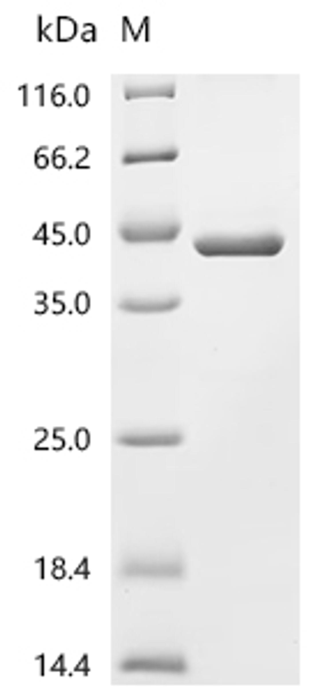 (Tris-Glycine gel) Discontinuous SDS-PAGE (reduced) with 5% enrichment gel and 15% separation gel.