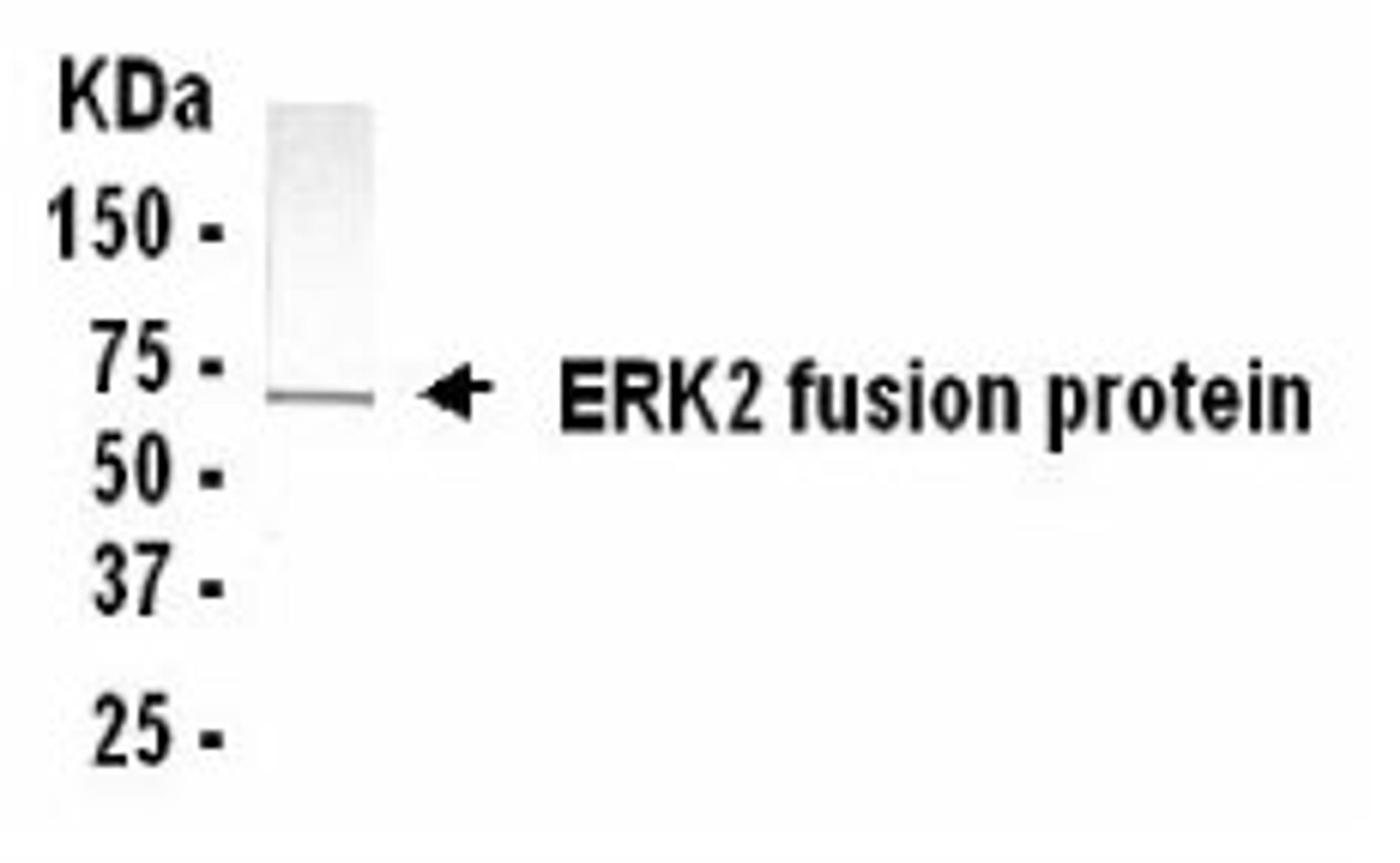 Western Blot: XW-7183 dilution: 1:2,000. Goat anti-14018-HRP dilution: 1:1,000. E coli-derived fusion protein as test antigen.