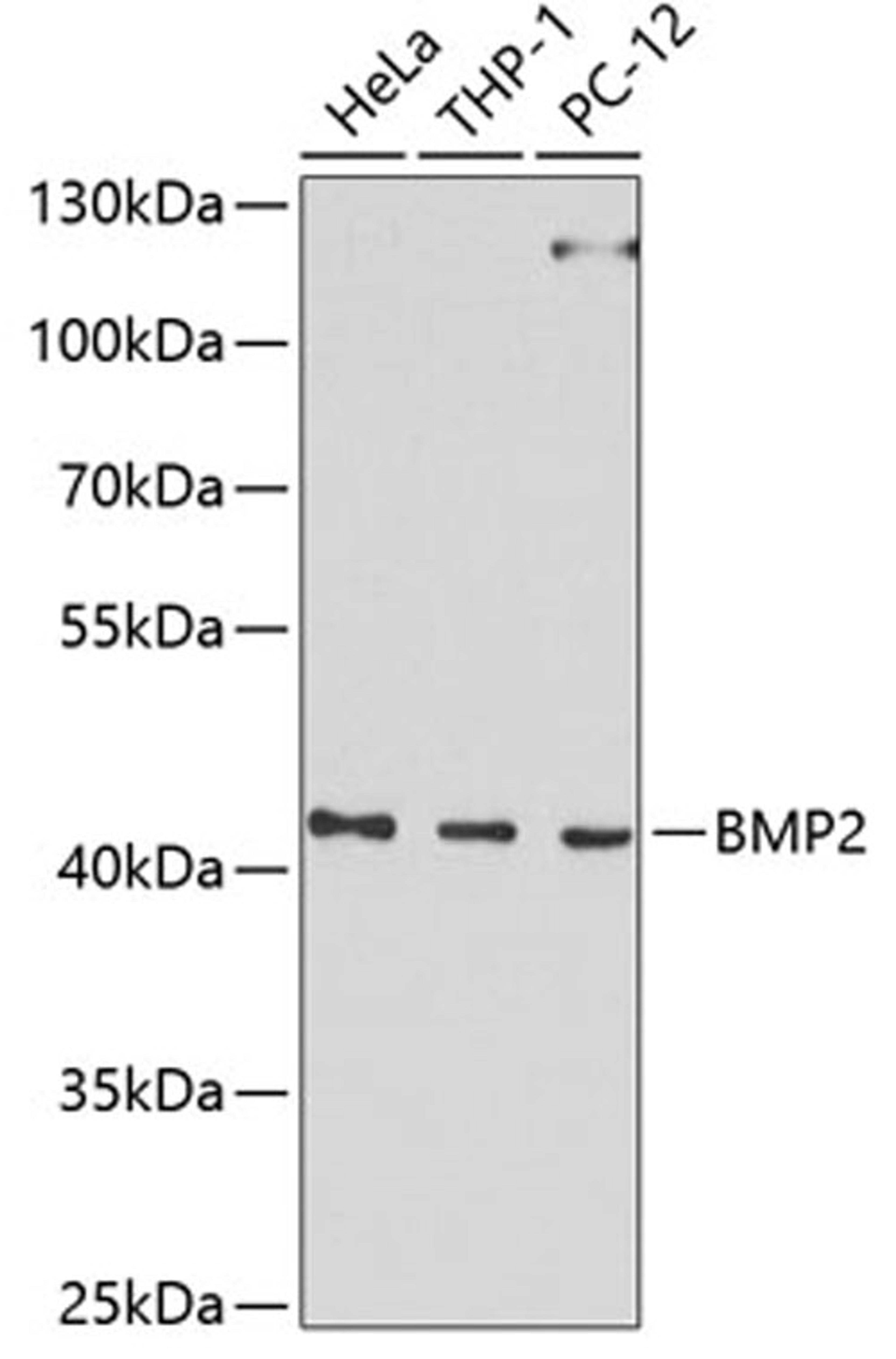 Western blot - BMP2 Antibody (A0231)