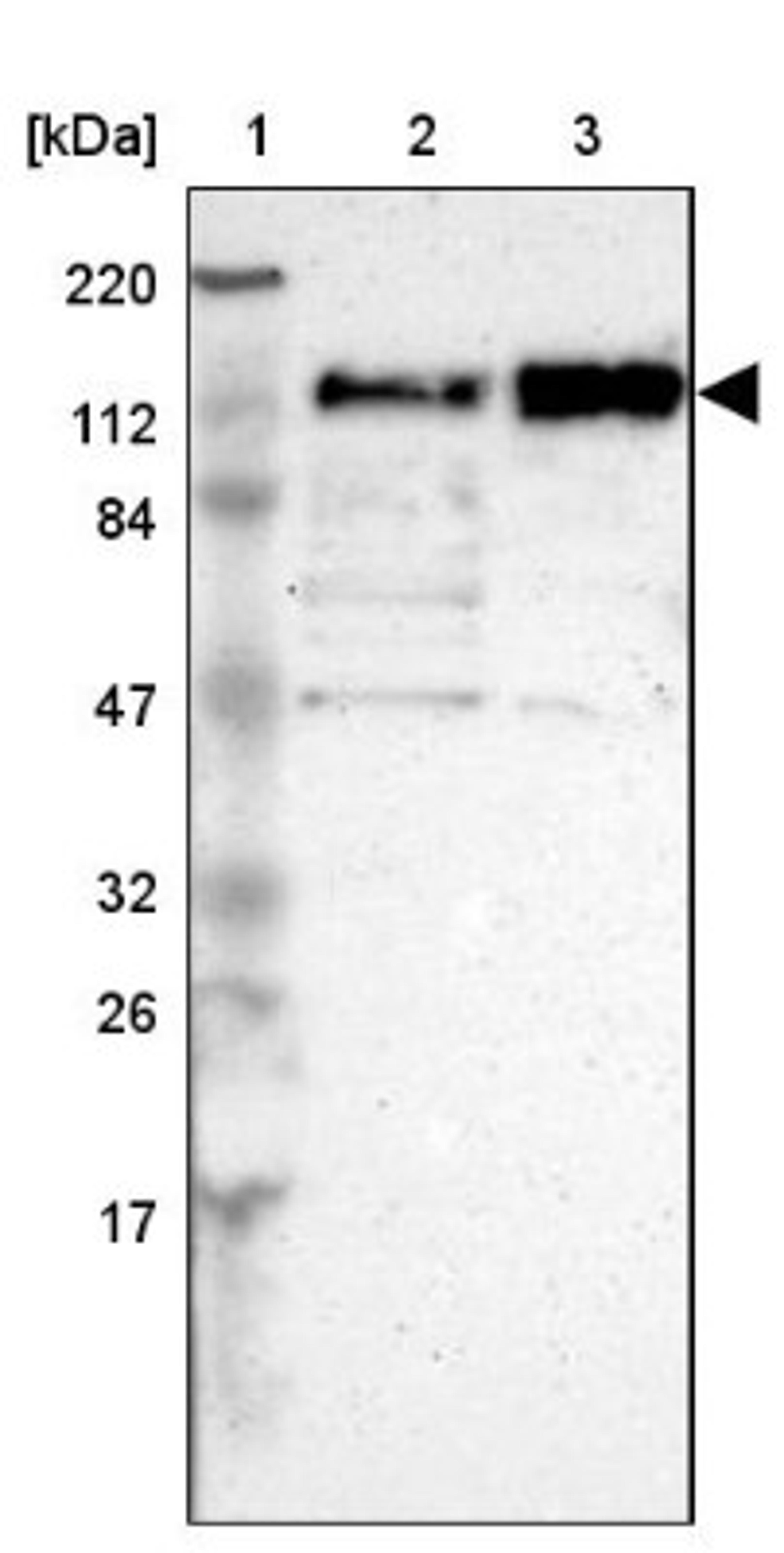 Western Blot: CEP97 Antibody [NBP1-83591] - Lane 1: Marker [kDa] 220, 112, 84, 47, 32, 26, 17<br/>Lane 2: Human cell line RT-4<br/>Lane 3: Human cell line U-251MG sp