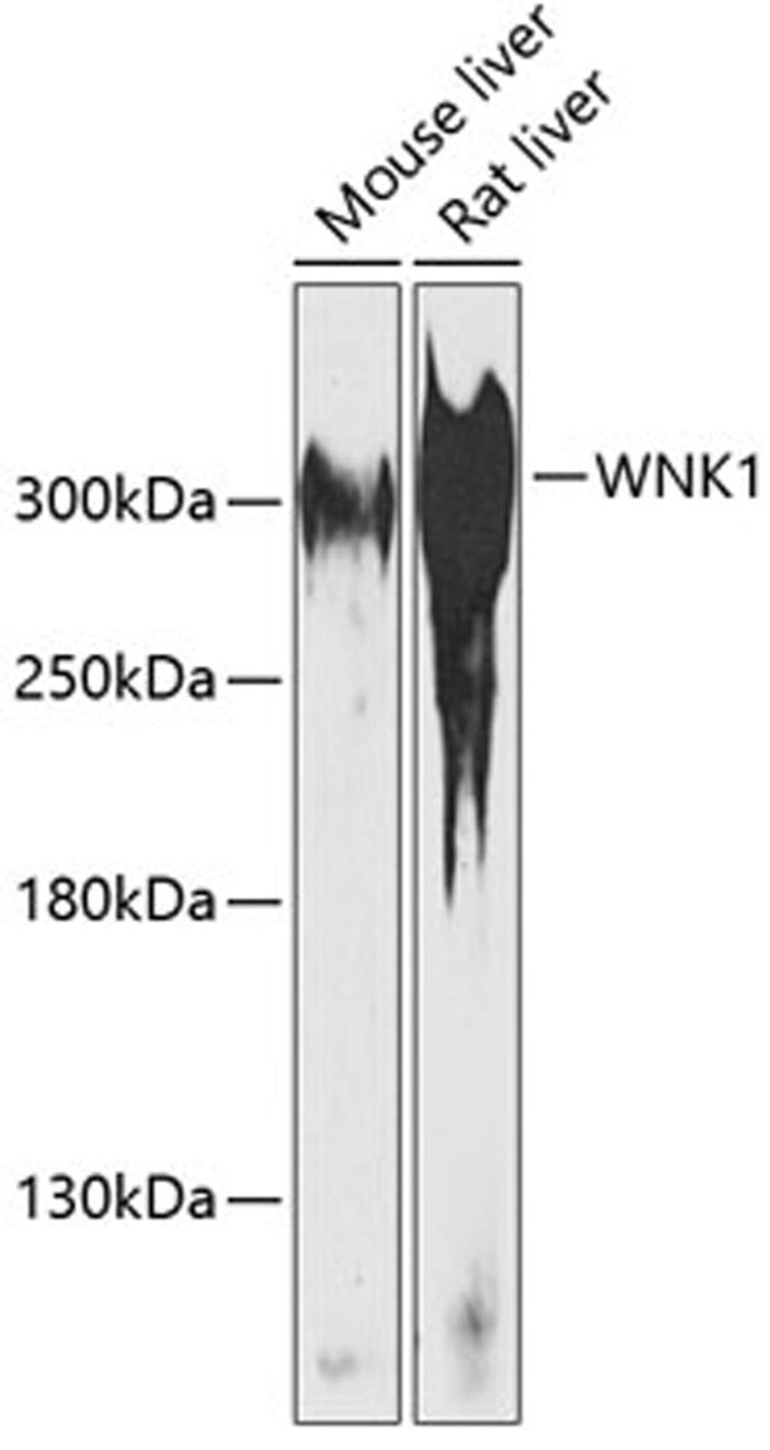 Western blot - WNK1 antibody (A14196)