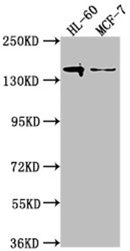 Western Blot. Positive WB detected in: HL-60 whole cell lysate, MCF-7 whole cell lysate. All lanes: FLT3 antibody at 1:2000. Secondary. Goat polyclonal to rabbit IgG at 1/50000 dilution. Predicted band size: 113, 109 kDa. Observed band size: 140 kDa.