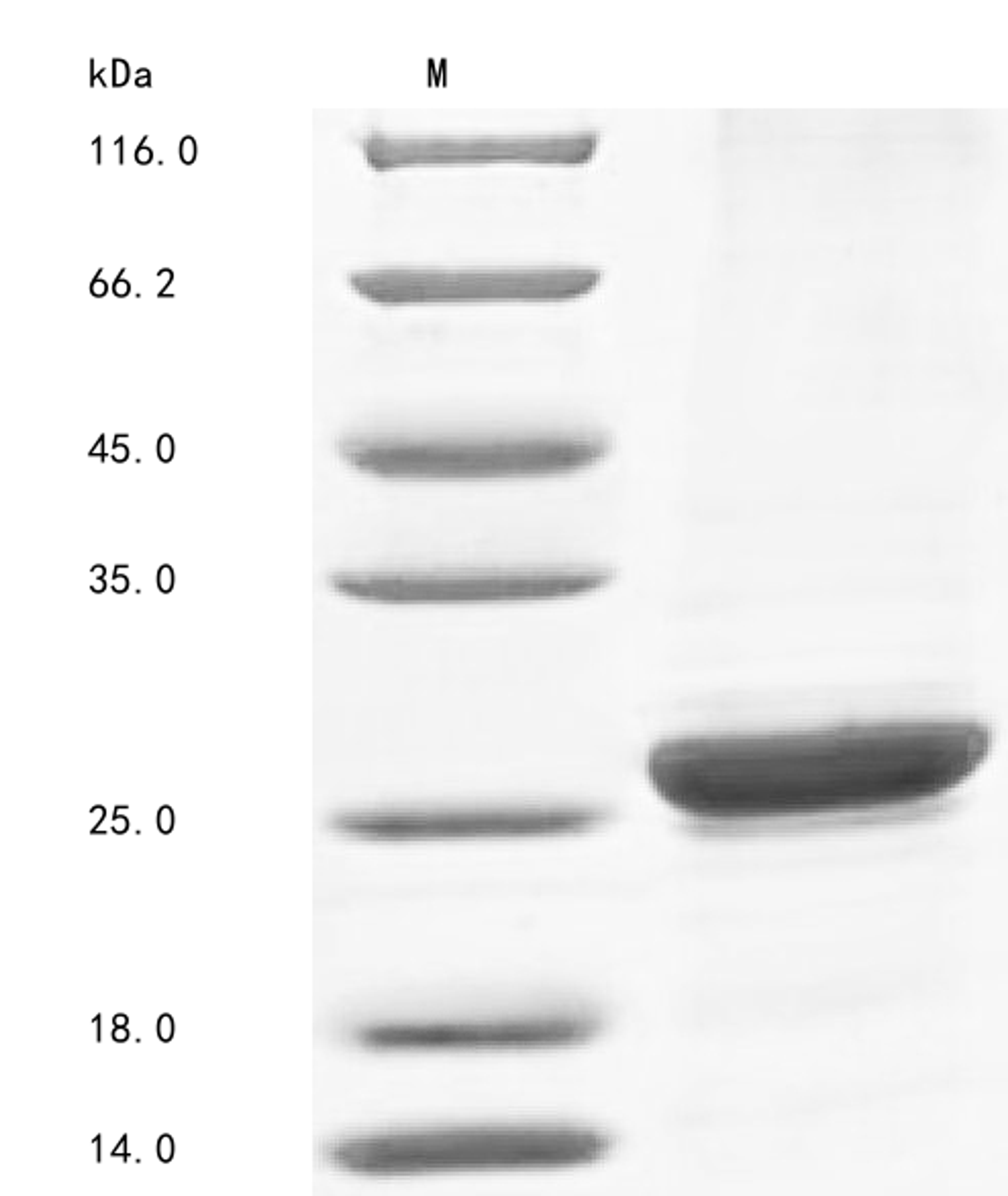 (Tris-Glycine gel) Discontinuous SDS-PAGE (reduced) with 5% enrichment gel and 15% separation gel.