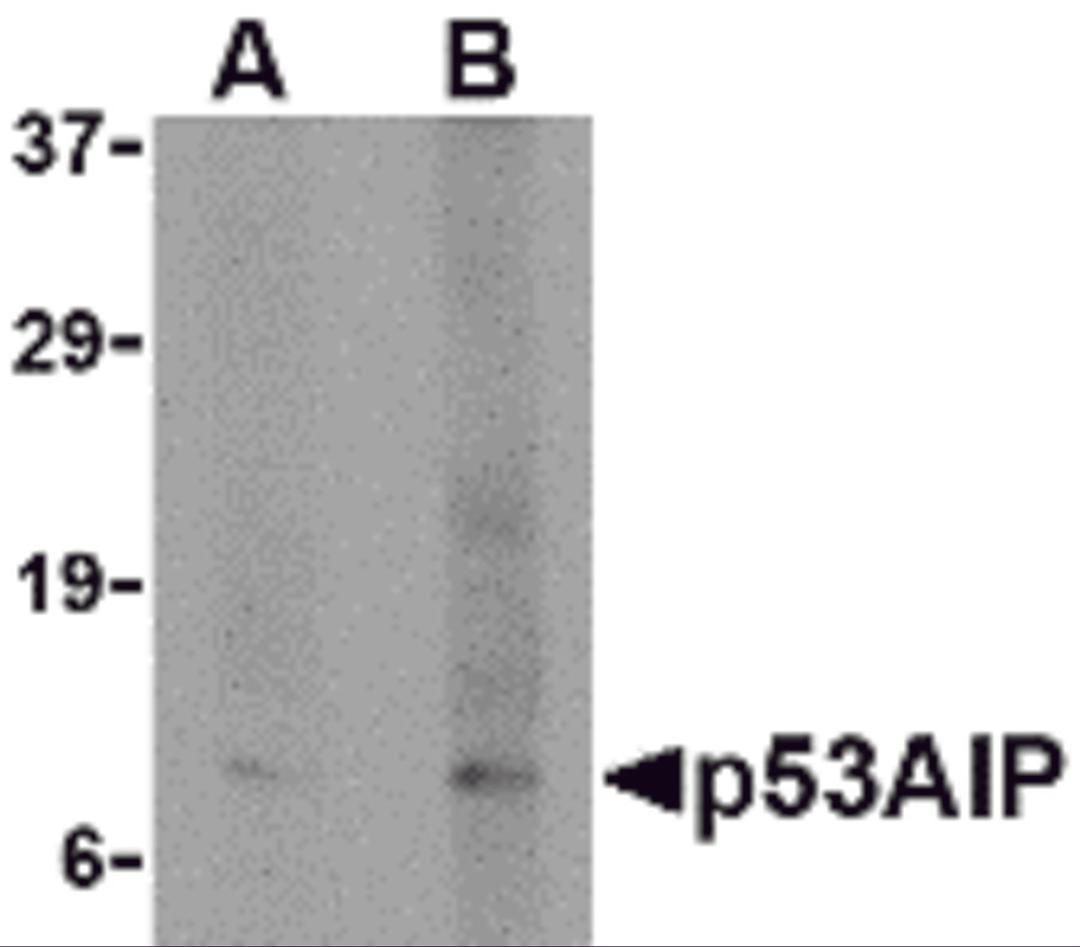 Western blot analysis of p53AIP1 in HL60 cell lysate with p53AIP1 antibody at (A) 4 and (B) 8 μg/mL.