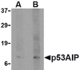 Western blot analysis of p53AIP1 in HL60 cell lysate with p53AIP1 antibody at (A) 4 and (B) 8 μg/mL.