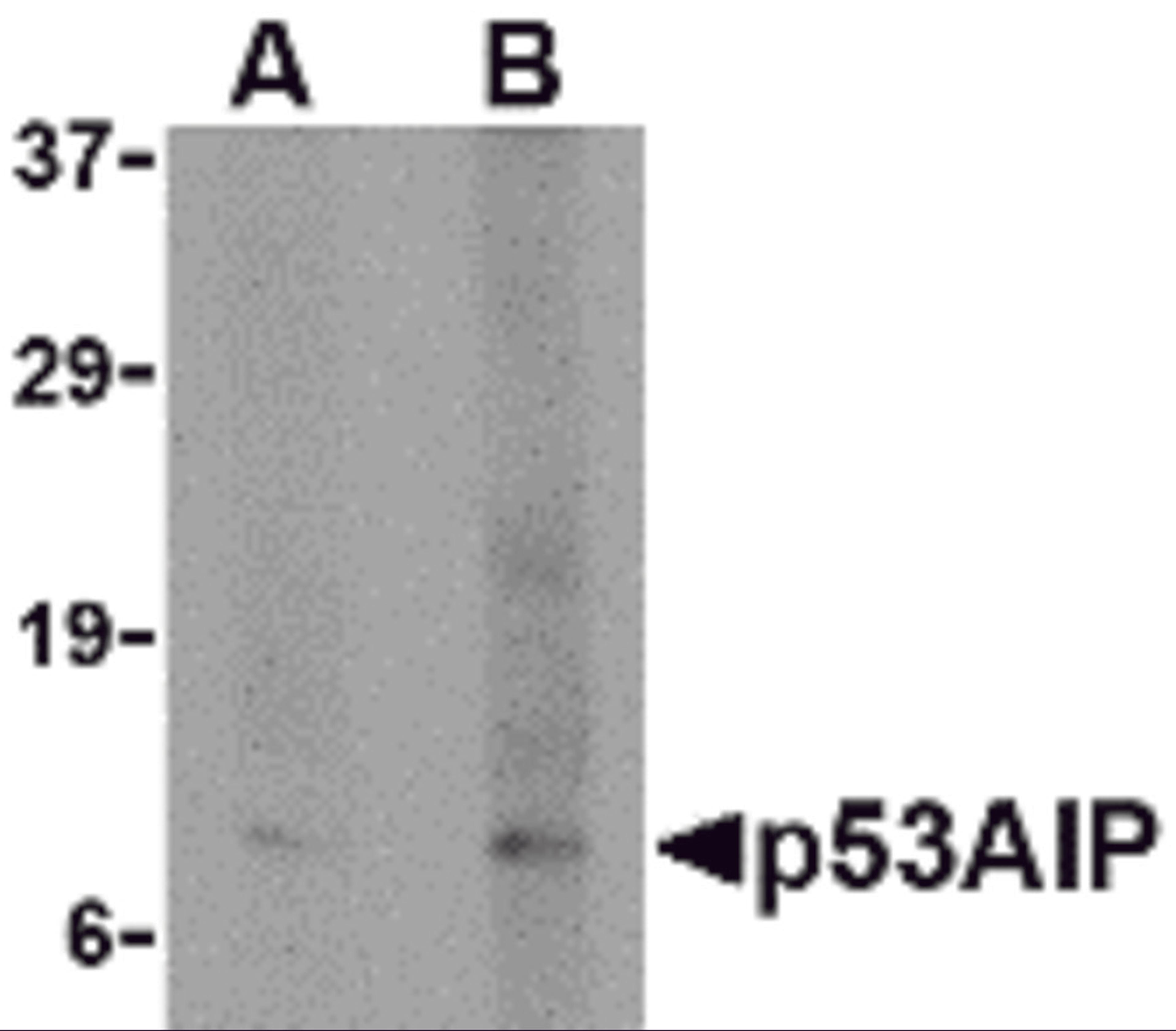Western blot analysis of p53AIP1 in HL60 cell lysate with p53AIP1 antibody at (A) 4 and (B) 8 μg/mL.