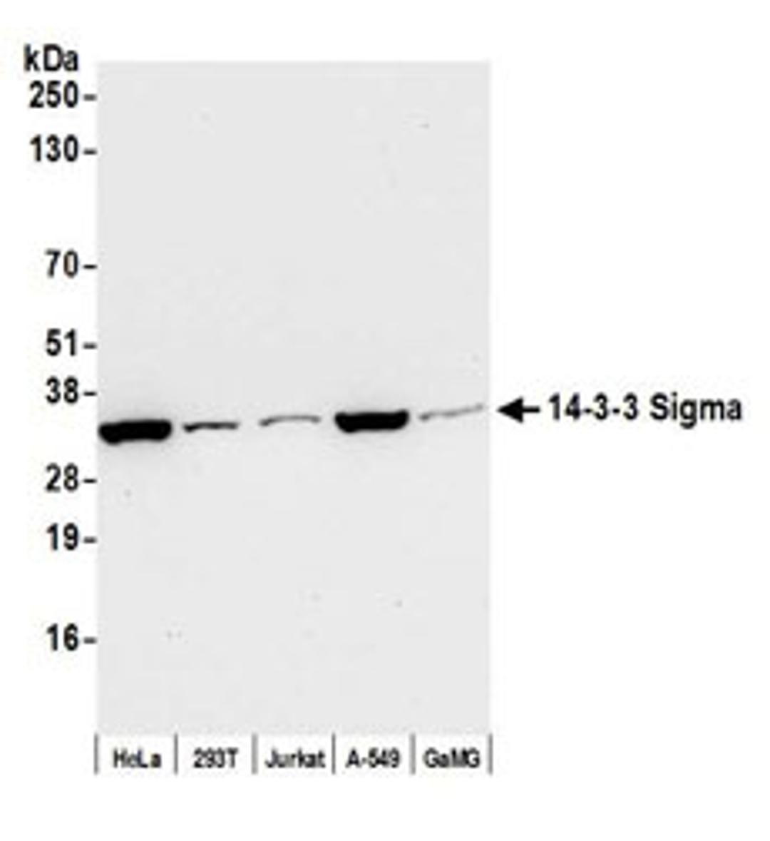 Detection of human 14-3-3 Sigma by western blot.