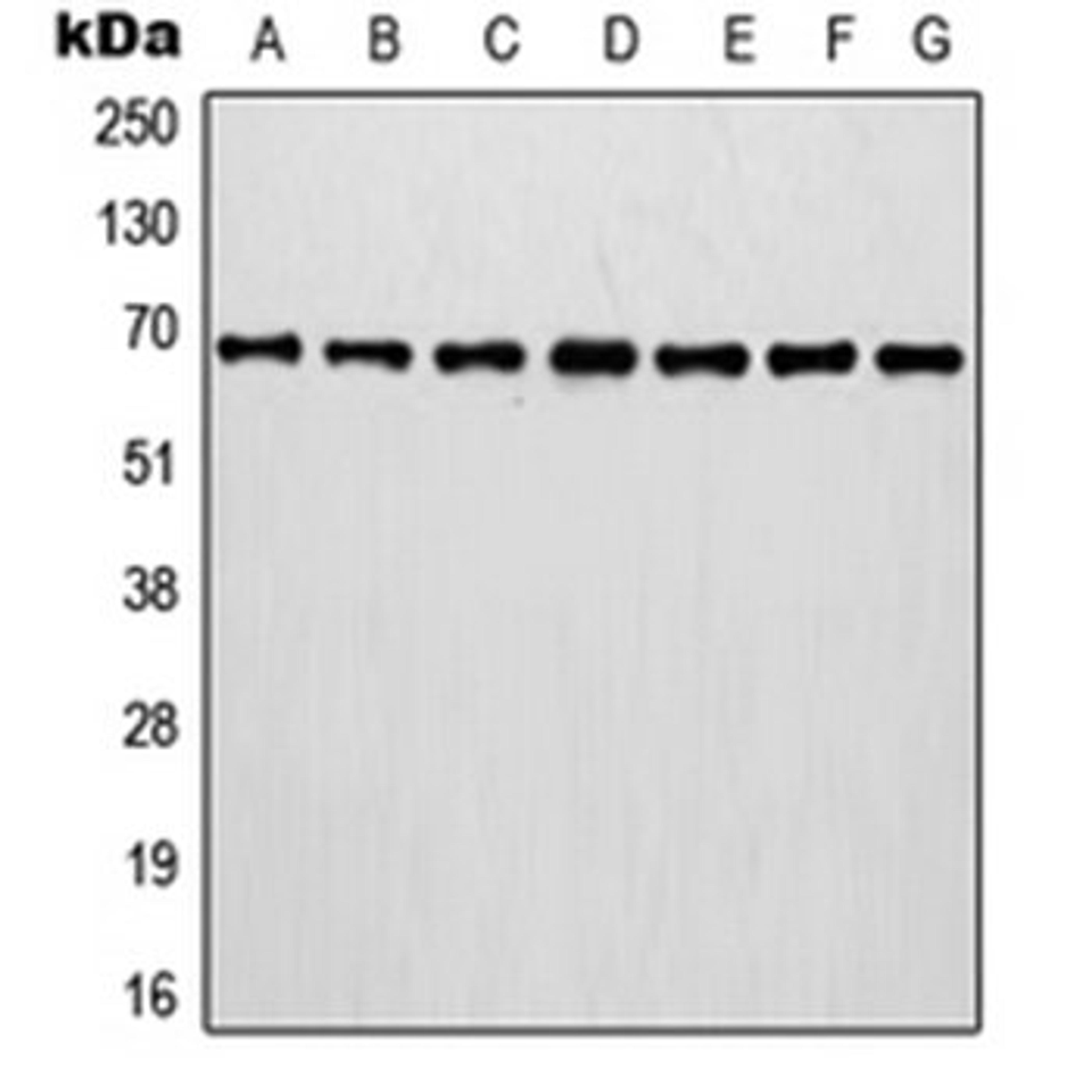 Western blot analysis of MCF7 (Lane 1), A375 (Lane 2), A431 (Lane 3), NIH3T3 (Lane 4), HT1080 (Lane 5), mouse brain (Lane 6), rat brain (Lane 7) whole cell lysates using IVL antibody