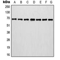 Western blot analysis of MCF7 (Lane 1), A375 (Lane 2), A431 (Lane 3), NIH3T3 (Lane 4), HT1080 (Lane 5), mouse brain (Lane 6), rat brain (Lane 7) whole cell lysates using IVL antibody