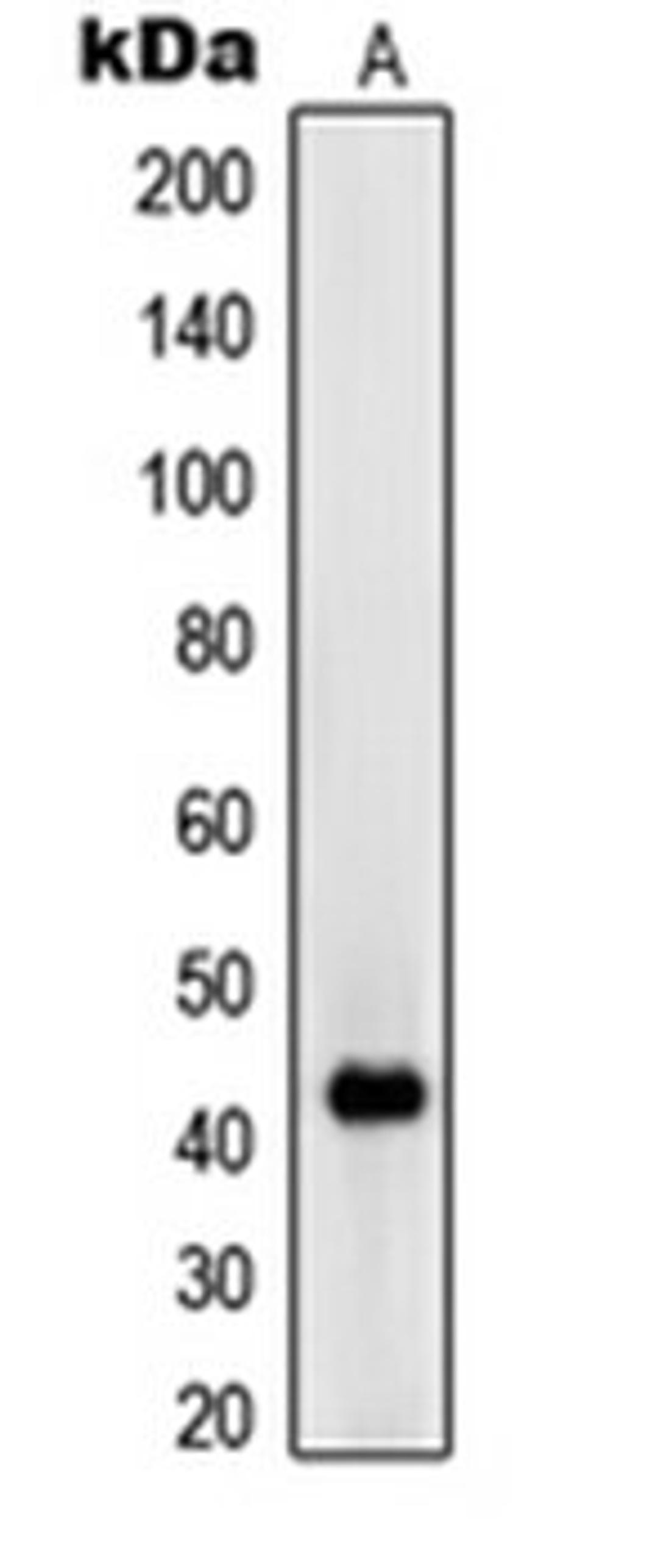 Western blot analysis of Jurkat (Lane 1) whole cell lysates using RIMKLA antibody