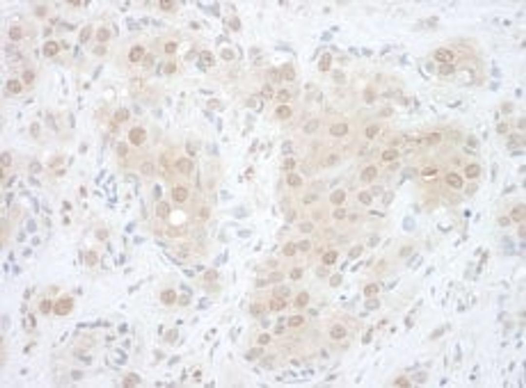 Detection of human EYA2 by immunohistochemistry.