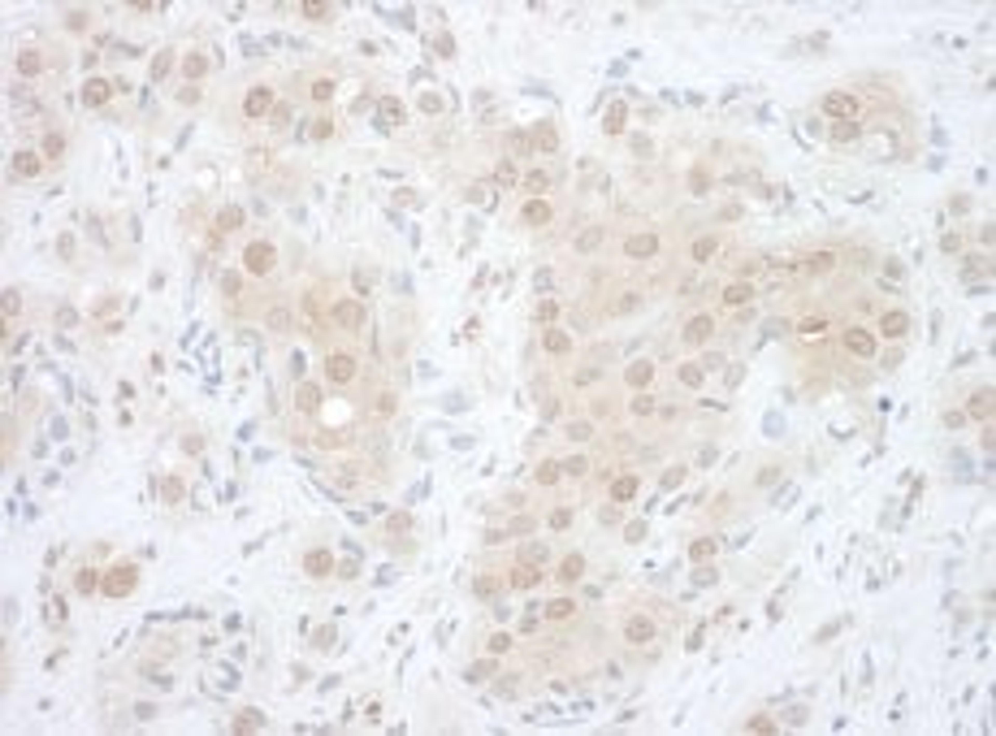 Detection of human EYA2 by immunohistochemistry.