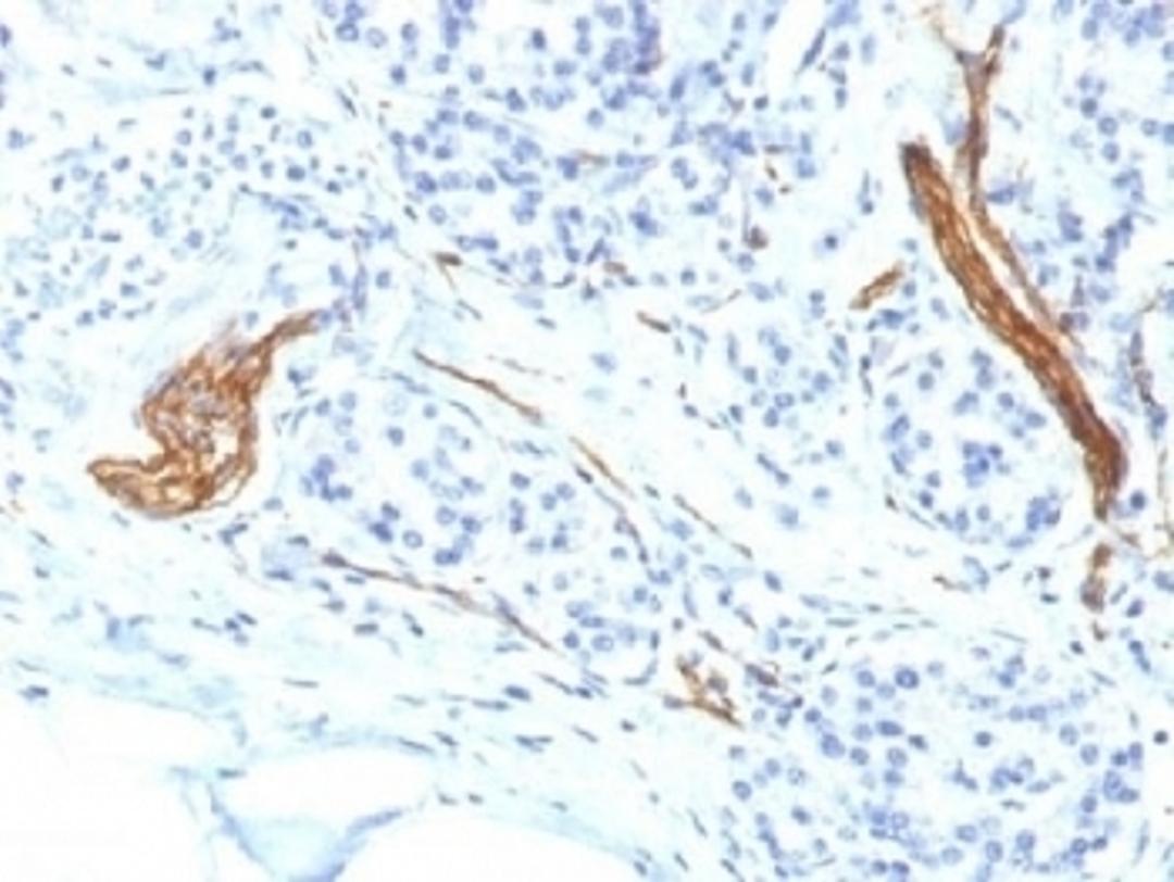 IHC testing of FFPE human pancreas with CD56 antibody (clone NCAM1/1496). Required HEIR: boil tissue sections in 10mM citrate buffer, pH 6, for 10-20 min.