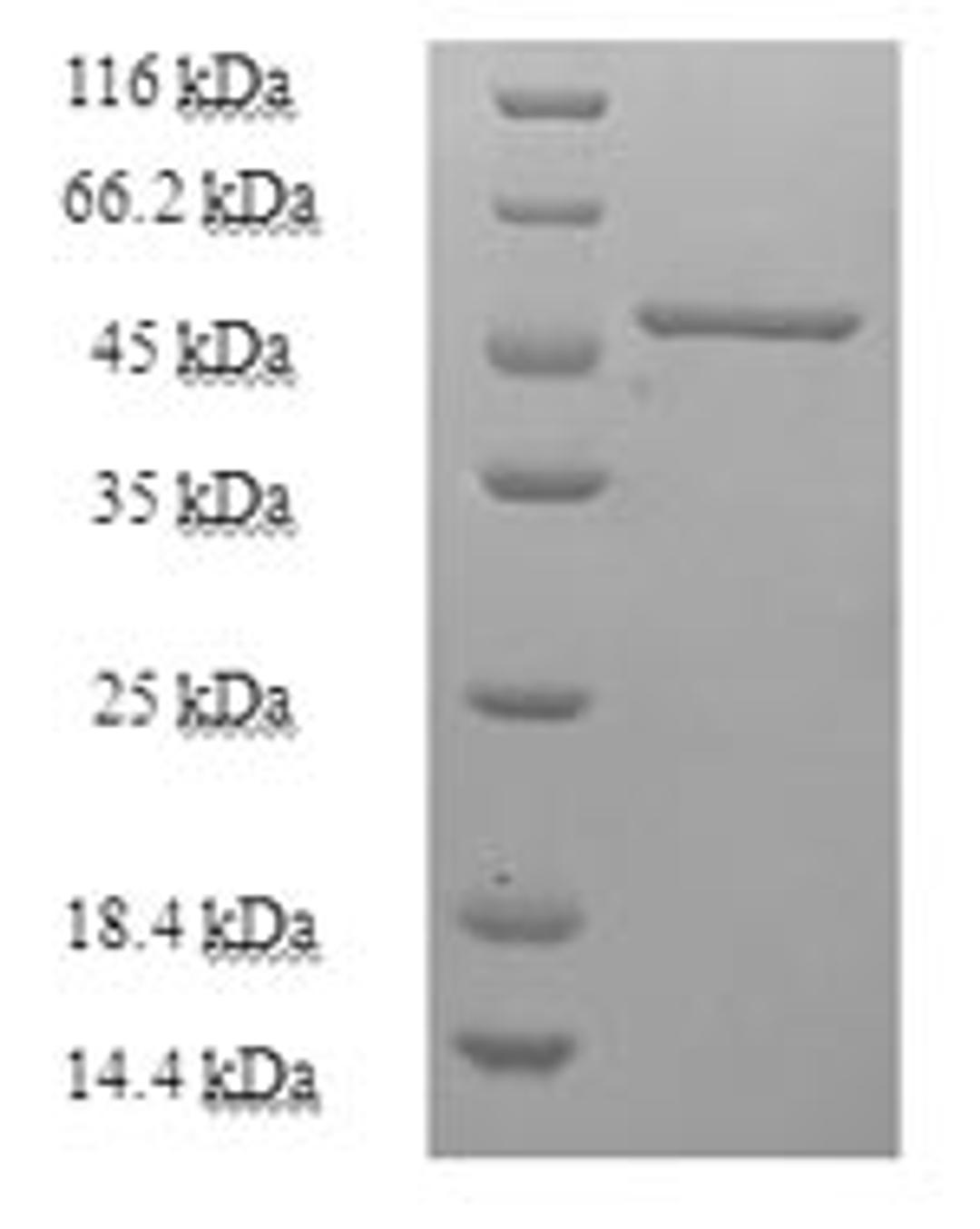 (Tris-Glycine gel) Discontinuous SDS-PAGE (reduced) with 5% enrichment gel and 15% separation gel.