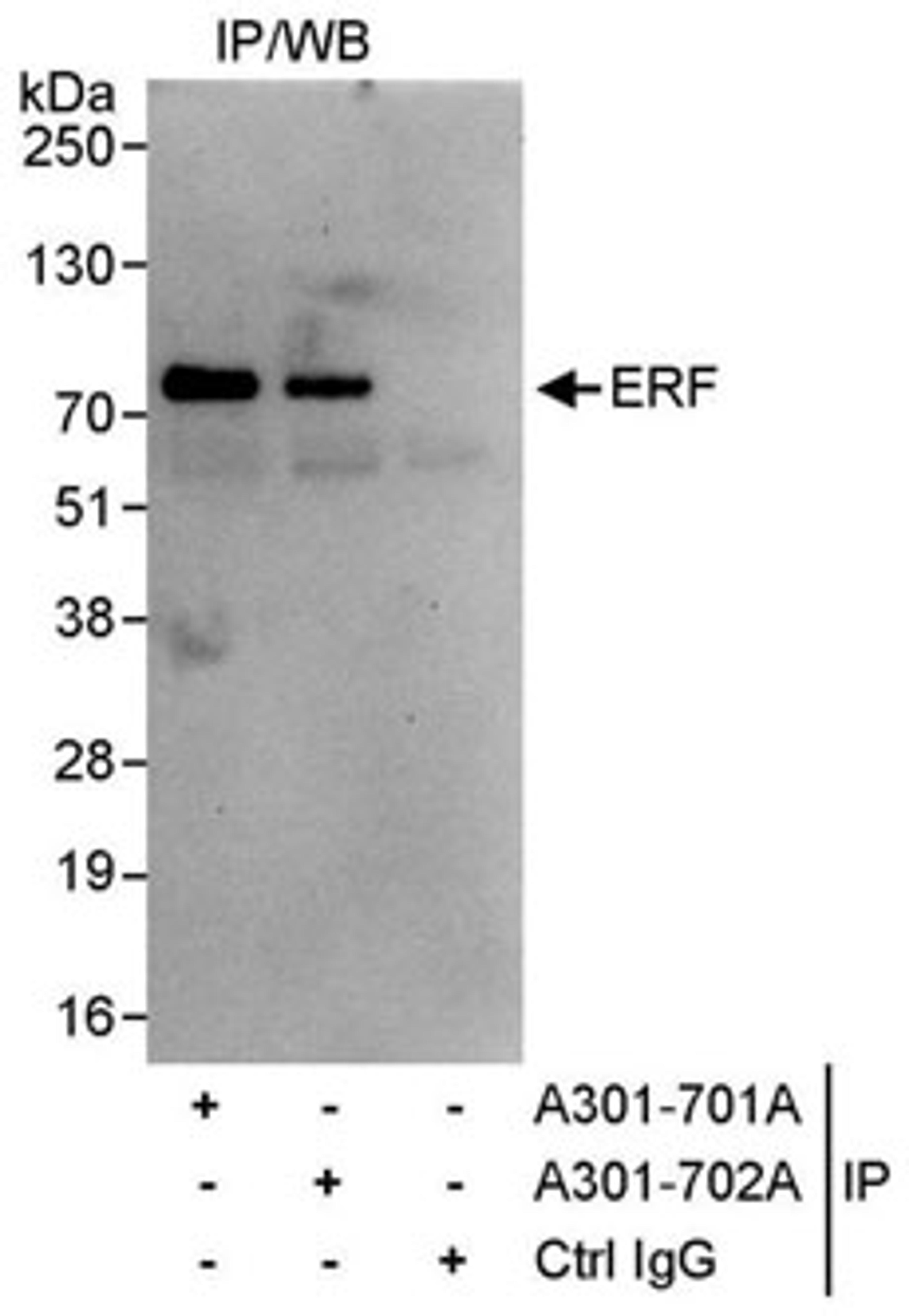 Detection of human ERF by western blot of immunoprecipitates.