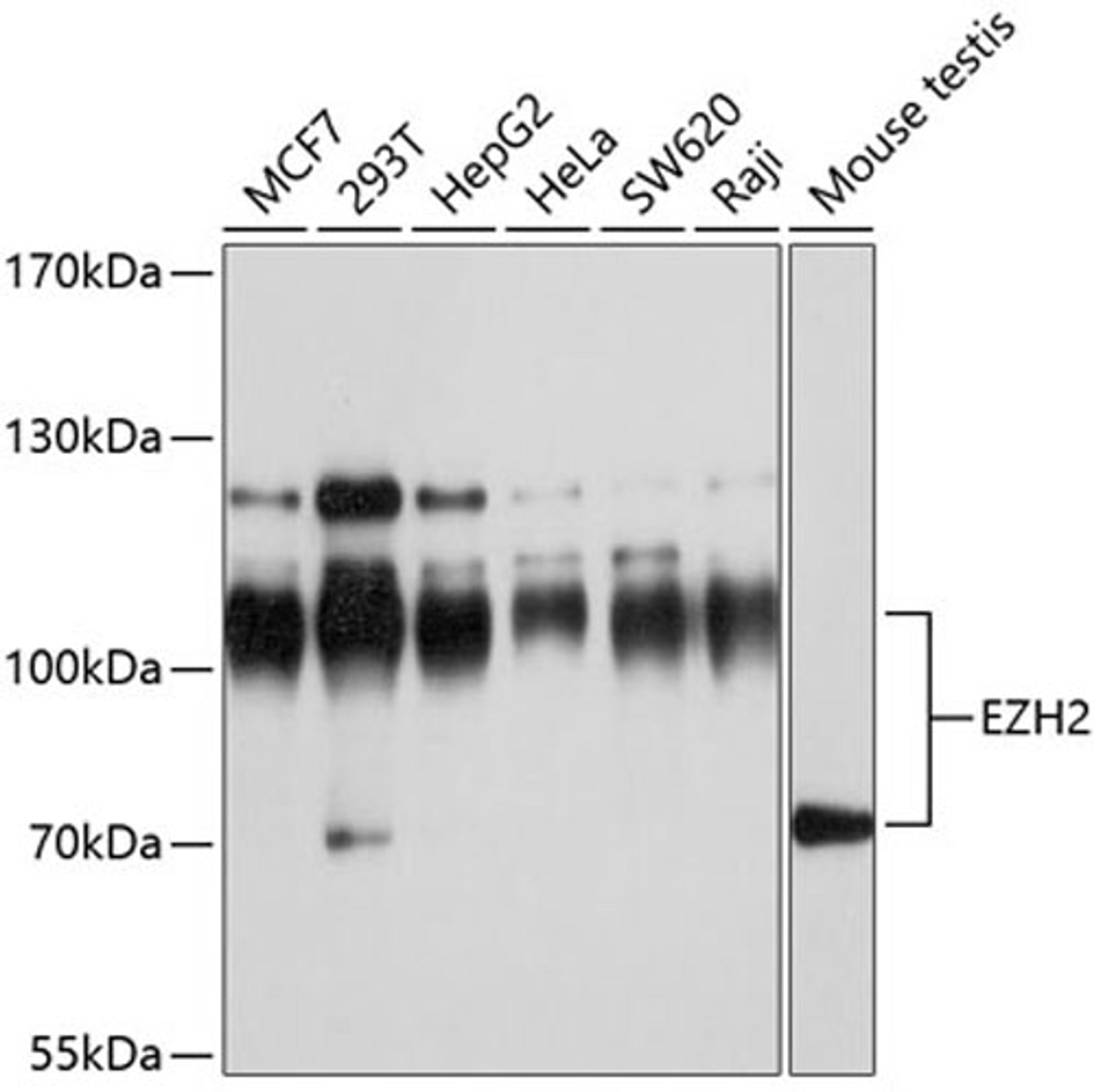 Western blot - EZH2 antibody (A11085)