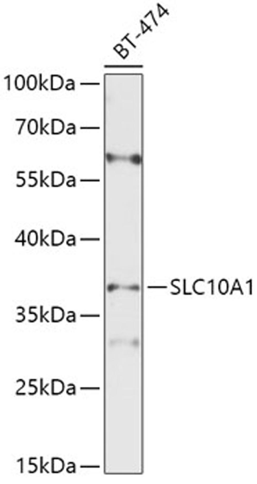 Western blot - SLC10A1 antibody (A10245)