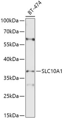 Western blot - SLC10A1 antibody (A10245)