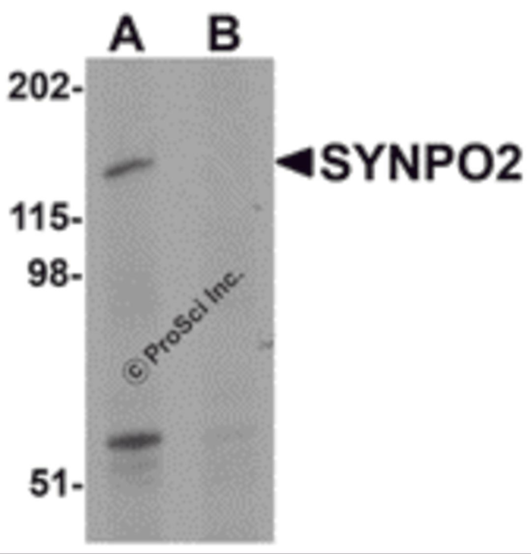 Western blot analysis of SYNPO2 in human skeletal muscle tissue lysate with SYNPO2 antibody at 1 μg/mL in (A) the absence and (B) the presence of blocking peptide.