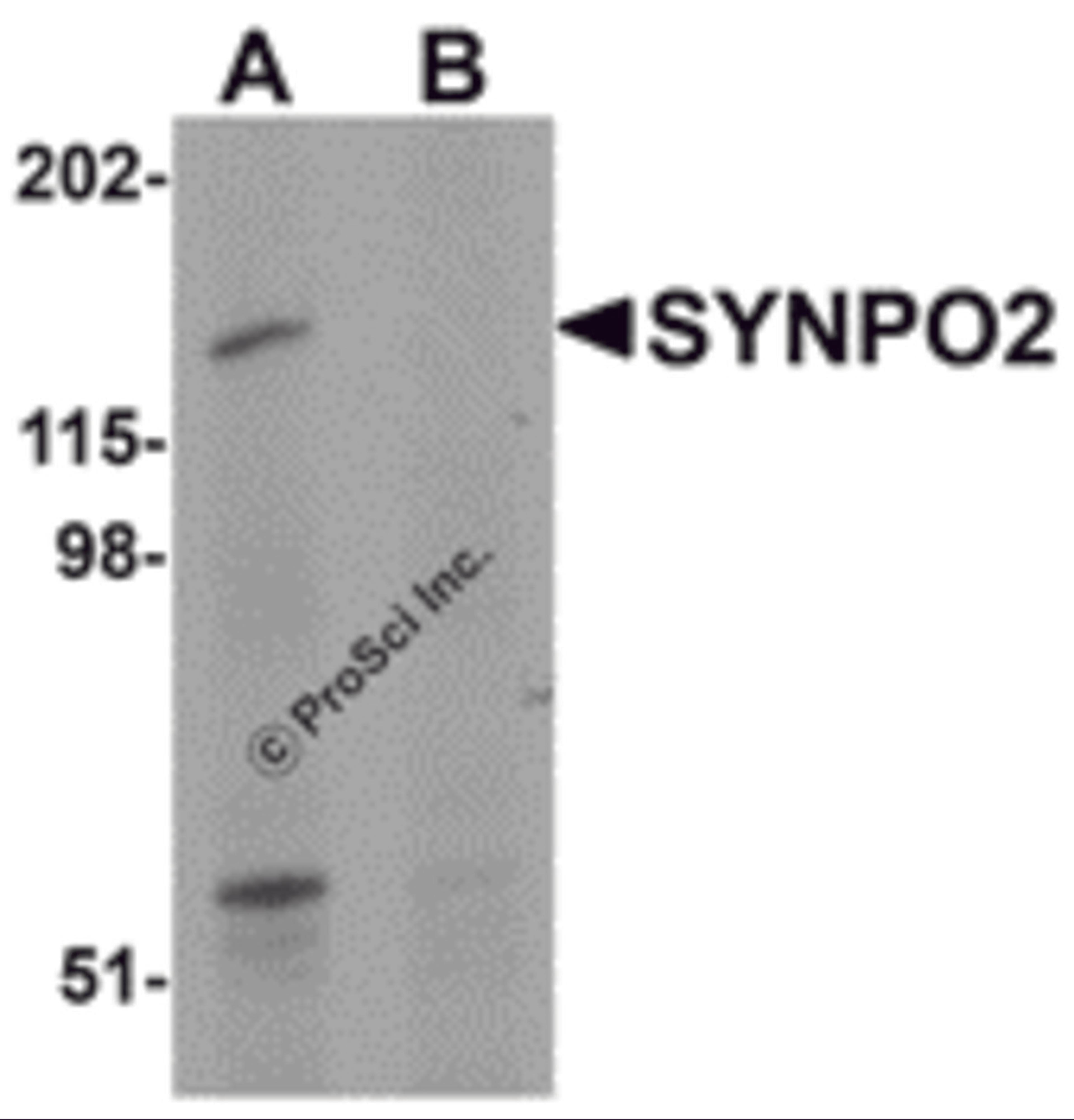 Western blot analysis of SYNPO2 in human skeletal muscle tissue lysate with SYNPO2 antibody at 1 μg/mL in (A) the absence and (B) the presence of blocking peptide.