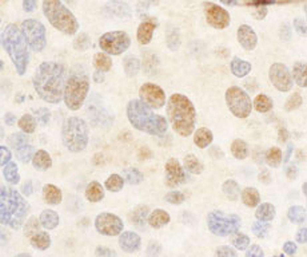 Detection of mouse c-Myb by immunohistochemistry.