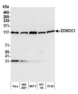 Detection of human ZCWCC1 by western blot.