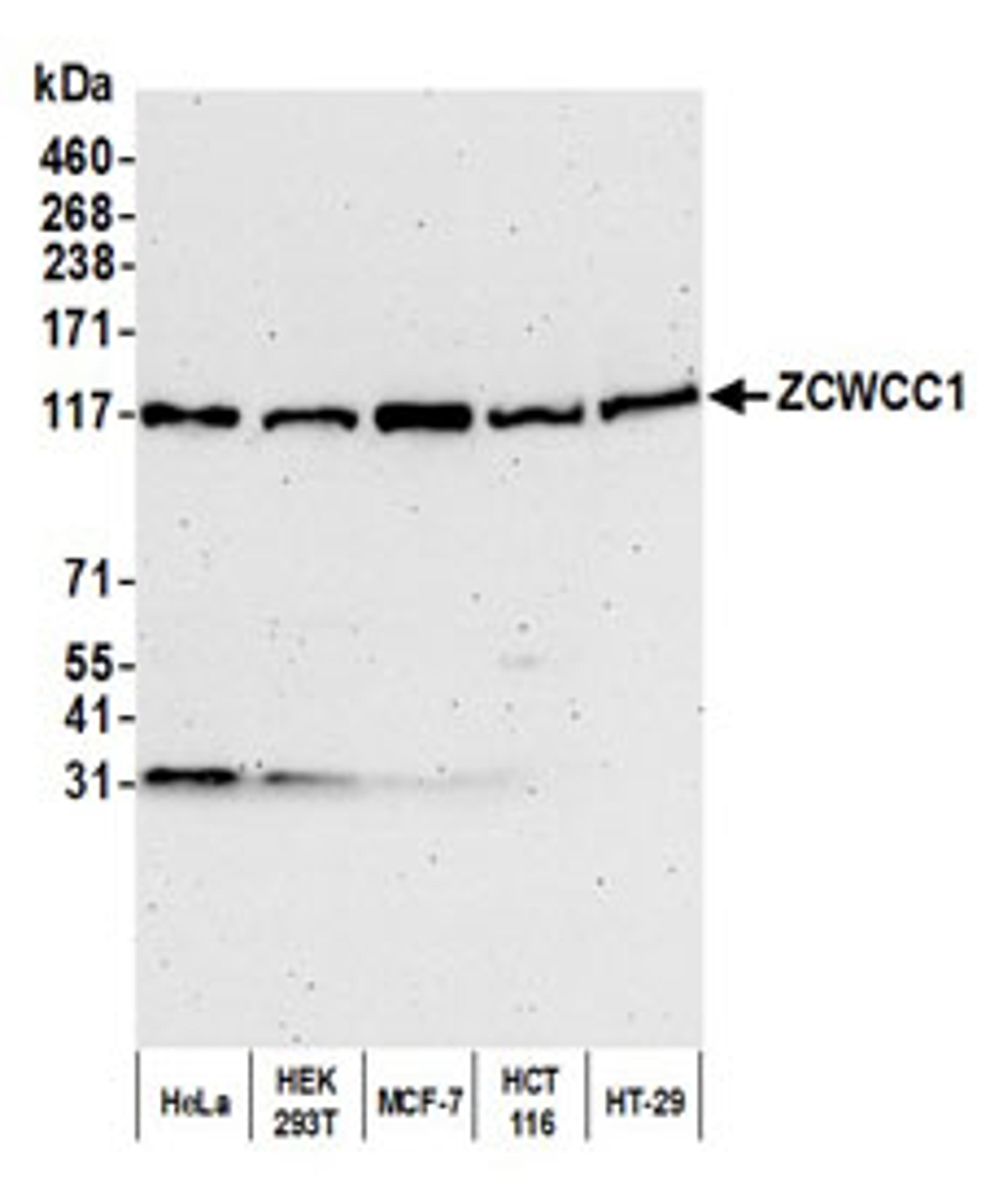 Detection of human ZCWCC1 by western blot.