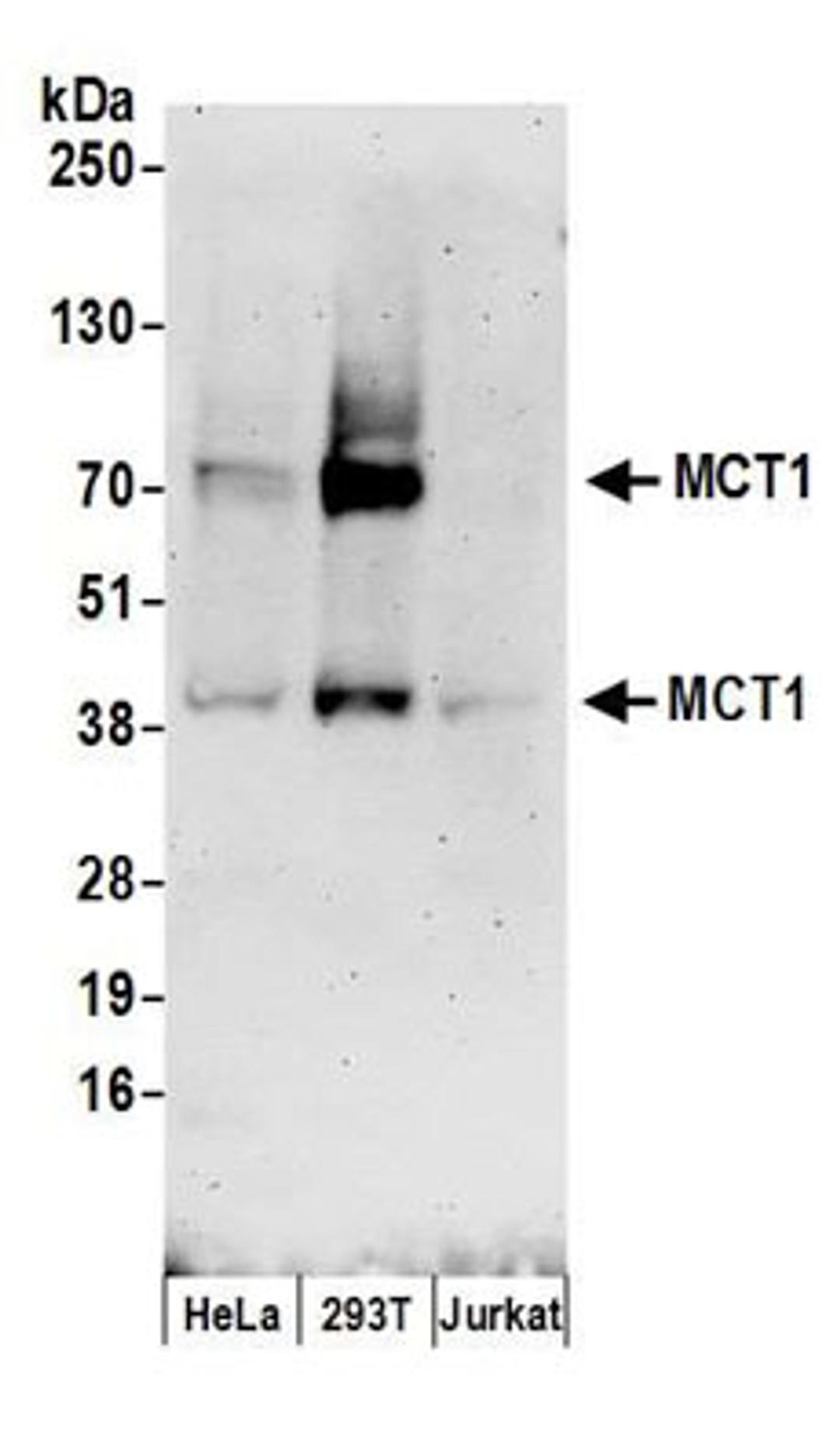 Detection of human MCT1 by western blot.