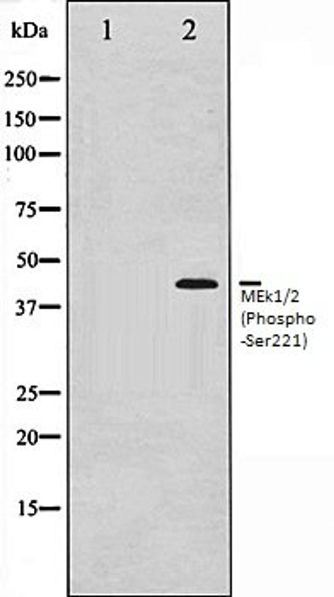 Western blot analysis of Jurkat whole cell lysates using MEK1/2 (Phospho-Ser221) antibody, The lane on the left is treated with the antigen-specific peptide.