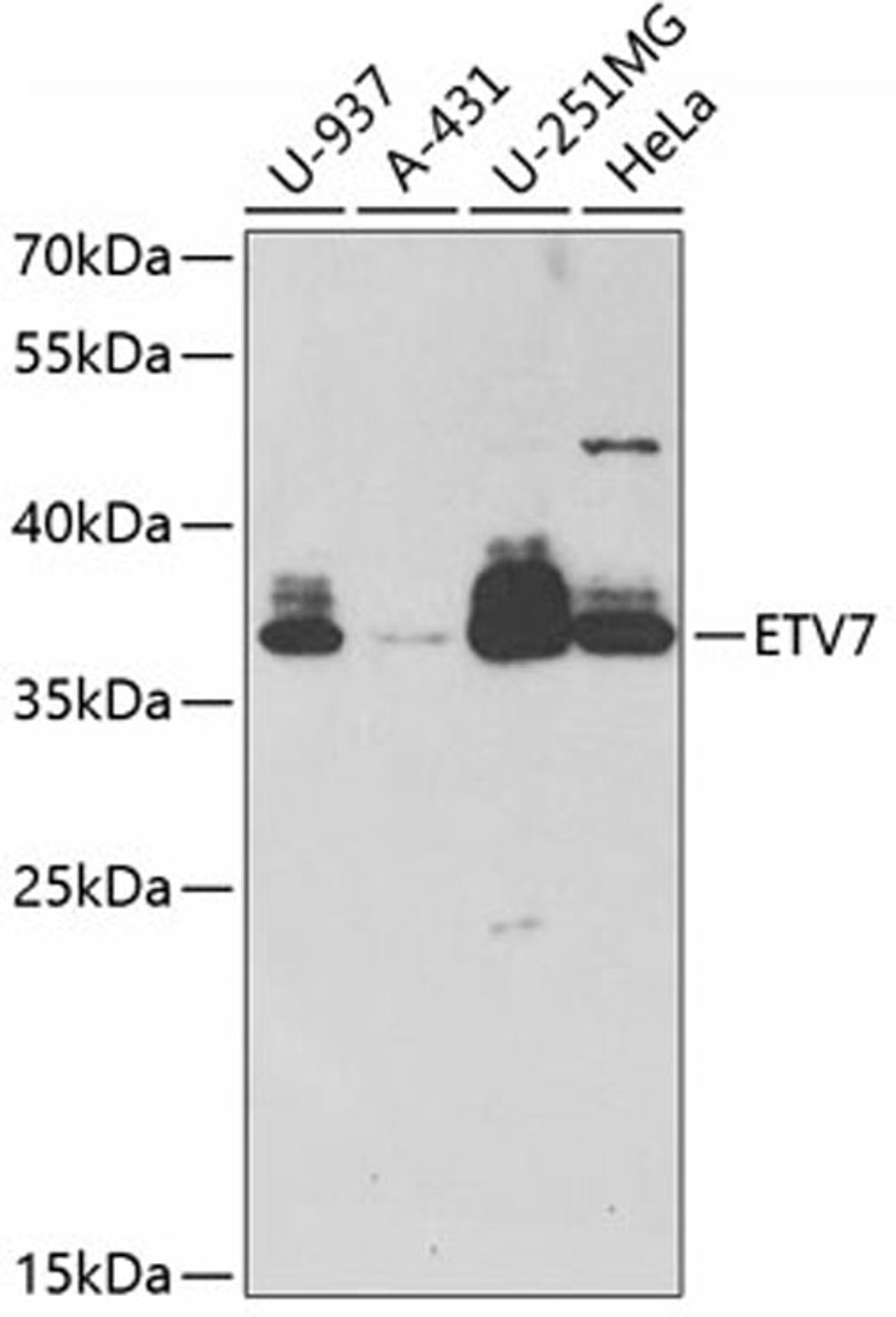 Western blot - ETV7 antibody (A6255)