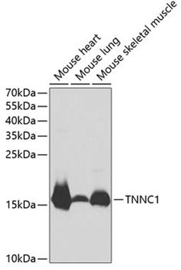 Western blot - TNNC1 antibody (A1927)