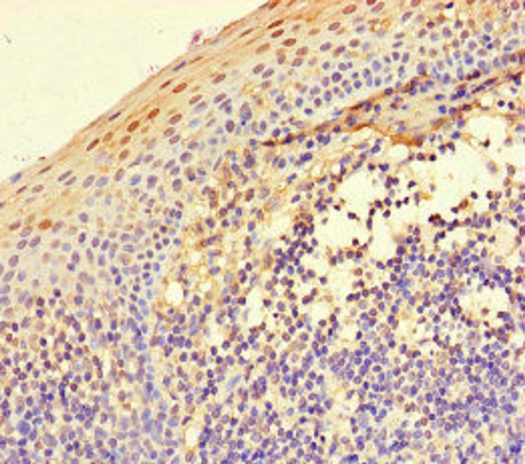 Immunohistochemistry of paraffin-embedded human tonsil tissue using CSB-PA011867LA01HU at dilution of 1:100