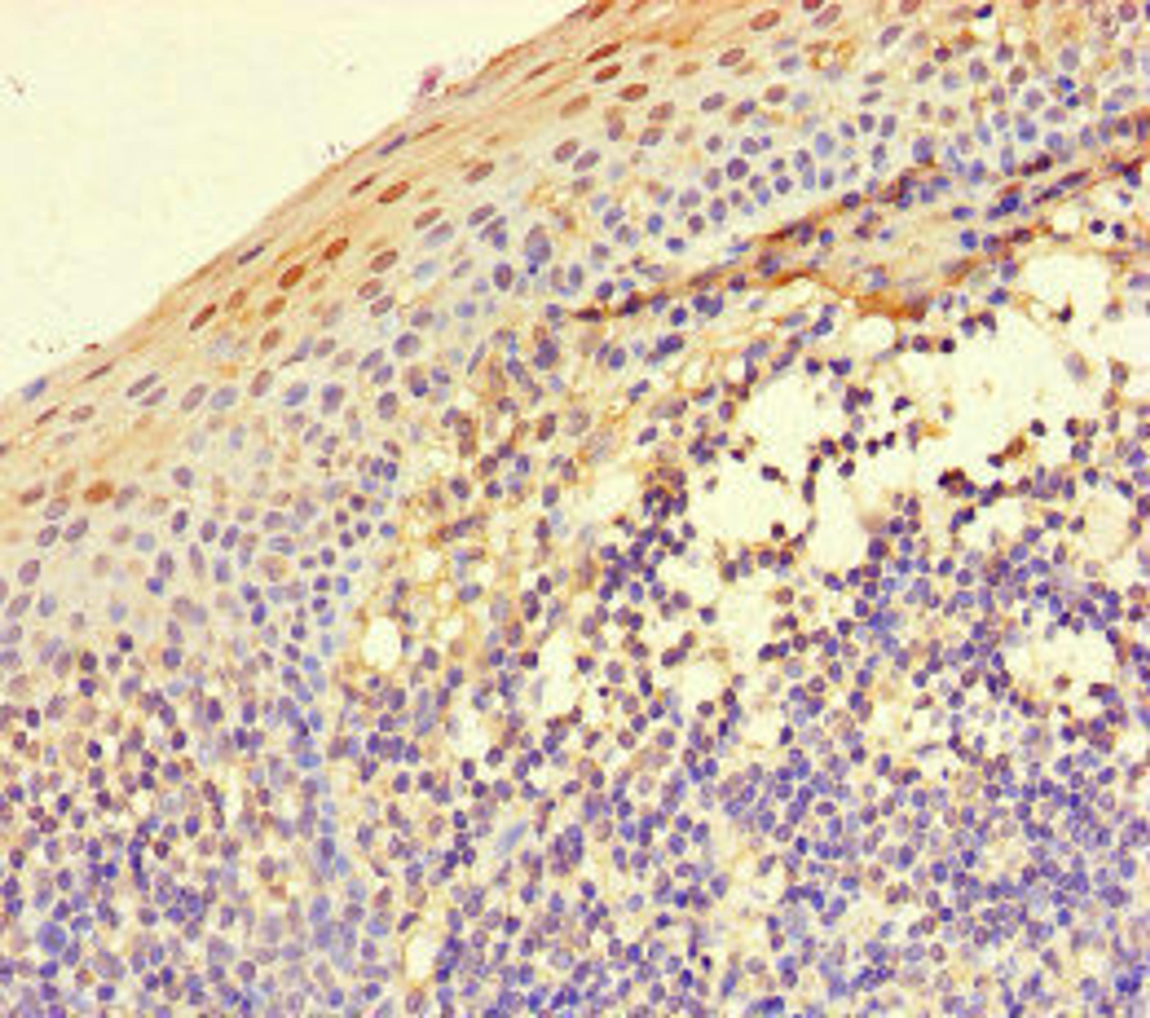 Immunohistochemistry of paraffin-embedded human tonsil tissue using CSB-PA011867LA01HU at dilution of 1:100