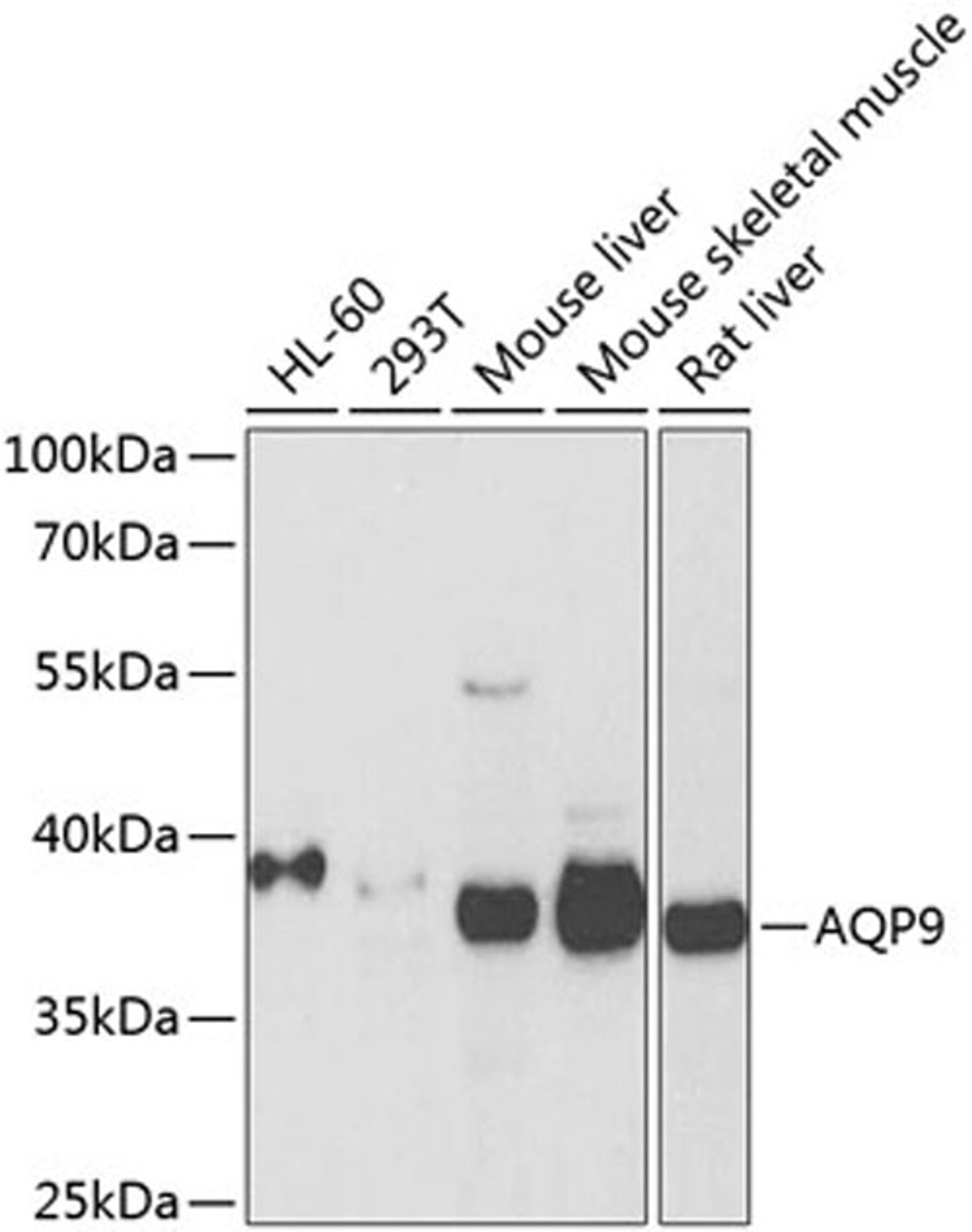 Western blot - AQP9 antibody (A8540)