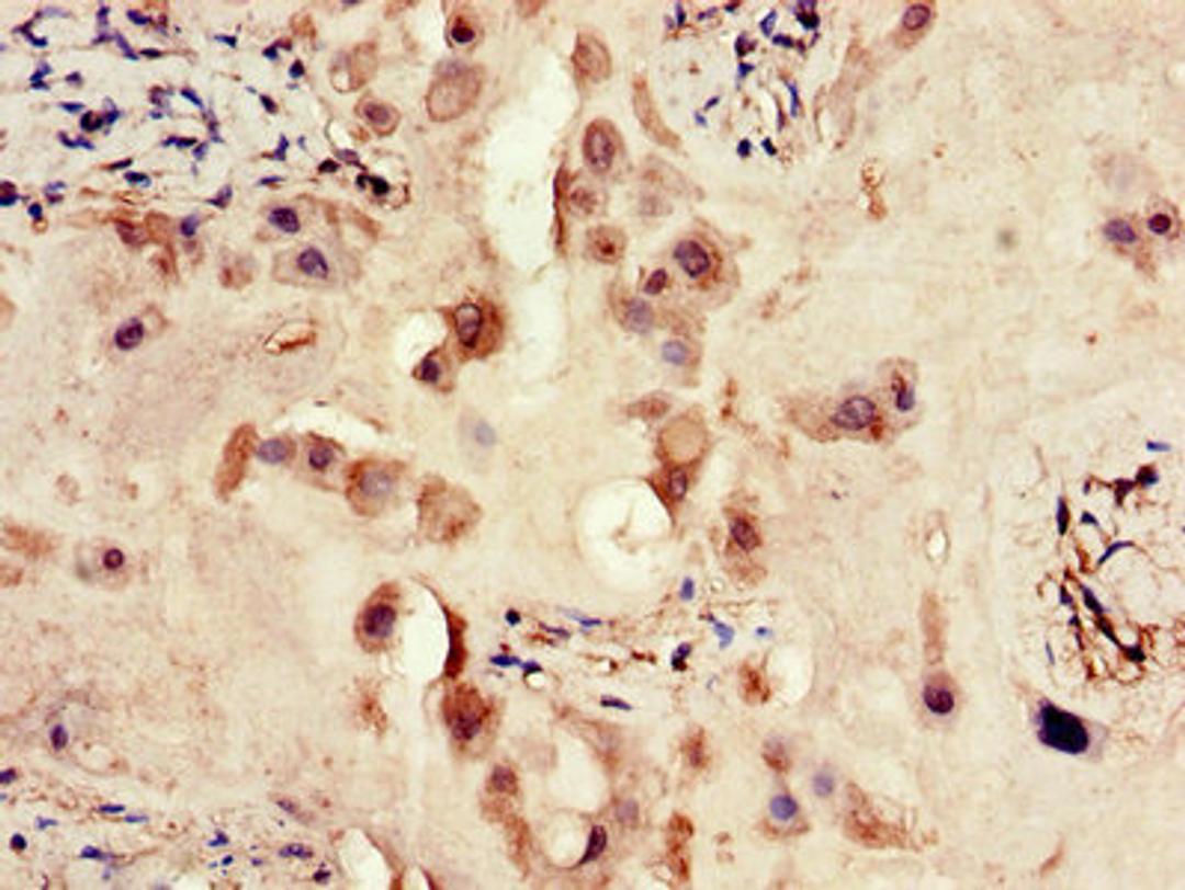 Immunohistochemistry of paraffin-embedded human placenta tissue using CSB-PA007766LA01HU at dilution of 1:100