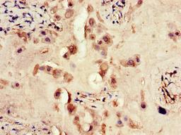 Immunohistochemistry of paraffin-embedded human placenta tissue using CSB-PA007766LA01HU at dilution of 1:100