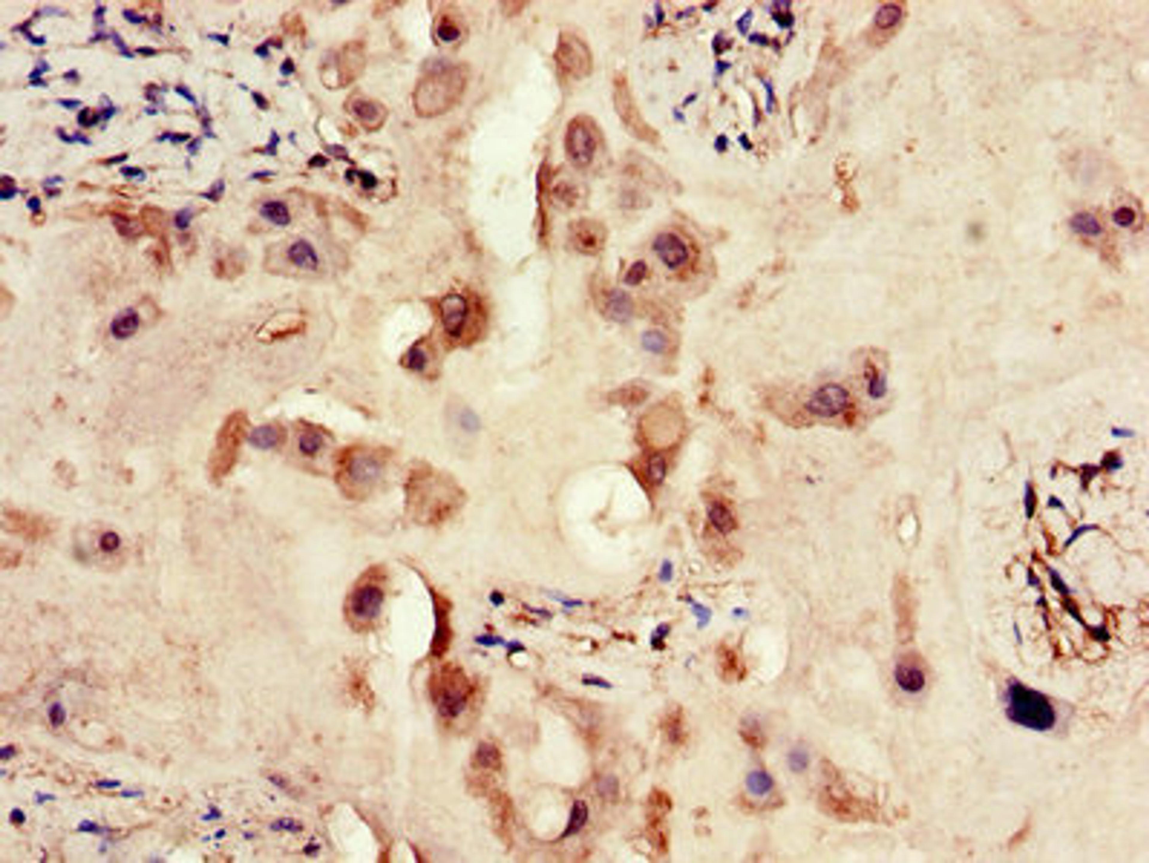 Immunohistochemistry of paraffin-embedded human placenta tissue using CSB-PA007766LA01HU at dilution of 1:100