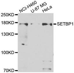 Western blot analysis of extracts of various cell lines using SETBP1 antibody