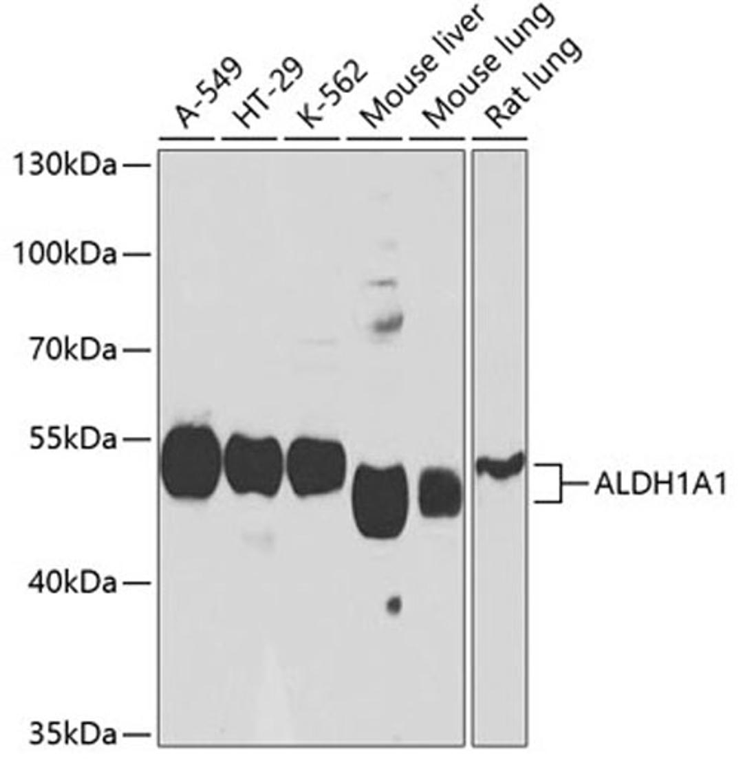 Western blot - ALDH1A1 antibody (A1802)