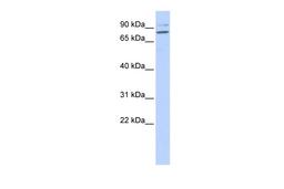 Antibody used in WB on Human Brain at 0.2-1 ug/ml.