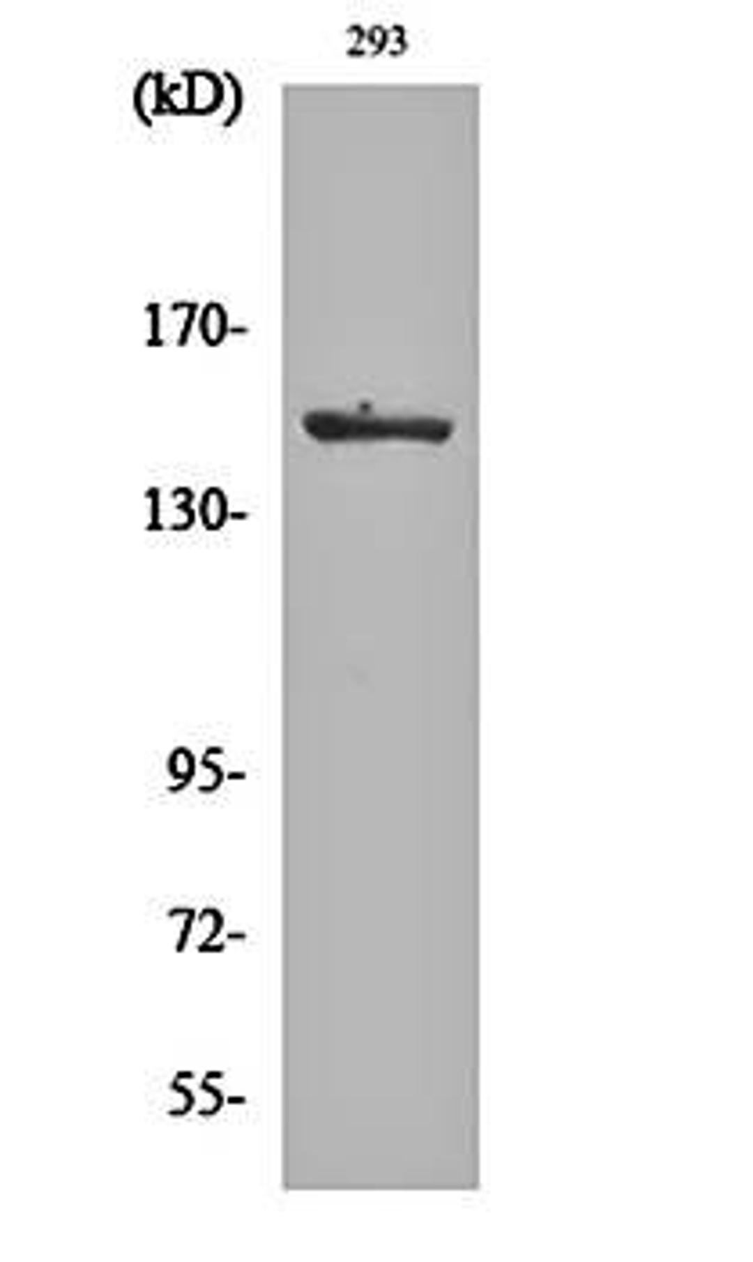 Western blot analysis of 293 cell lysates using ASK 1 (phospho-S966) antibody