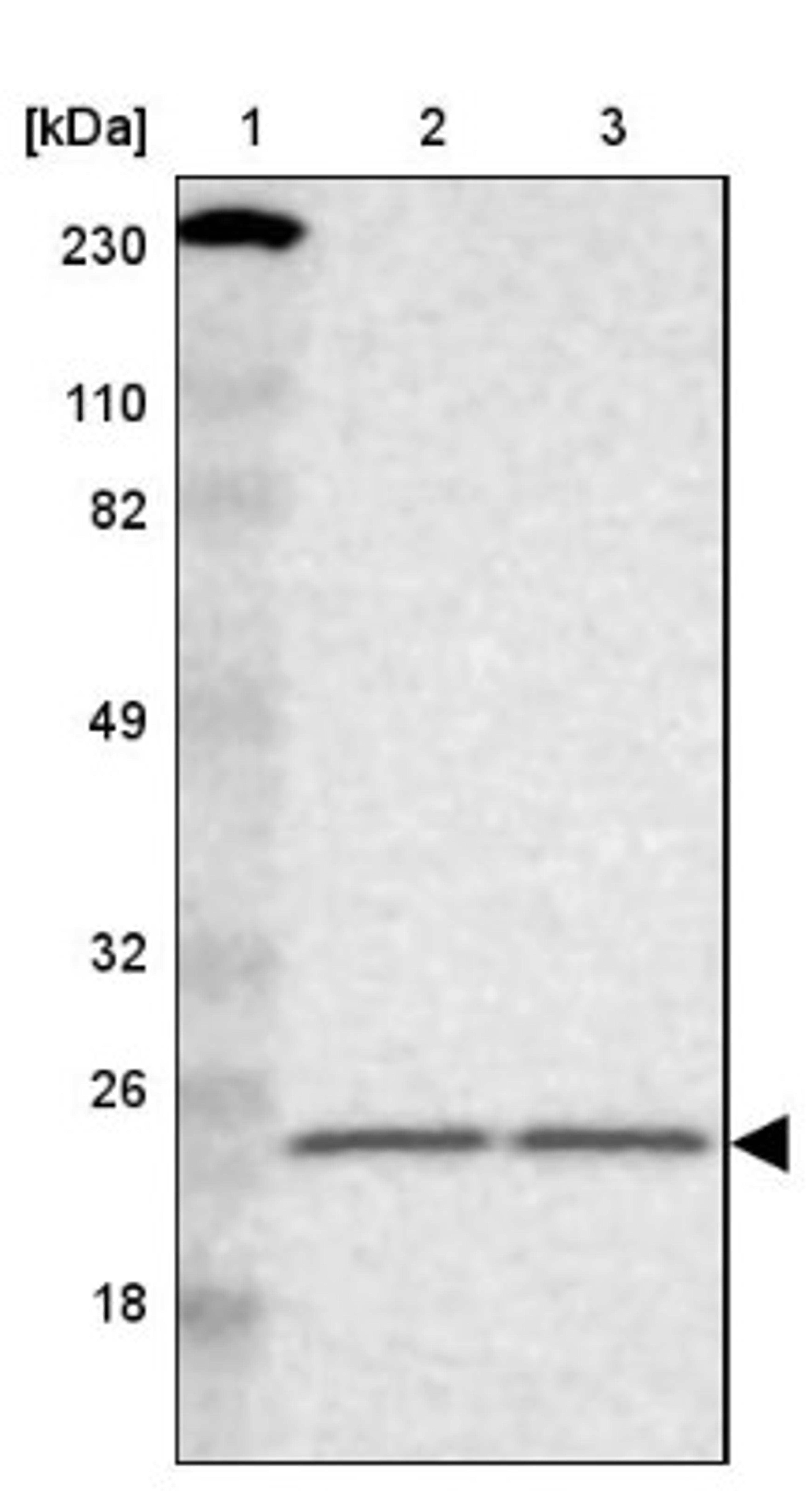 Western Blot: RAB13 Antibody [NBP1-85799] - Lane 1: Marker [kDa] 230, 110, 82, 49, 32, 26, 18<br/>Lane 2: Human cell line RT-4<br/>Lane 3: Human cell line U-251MG sp